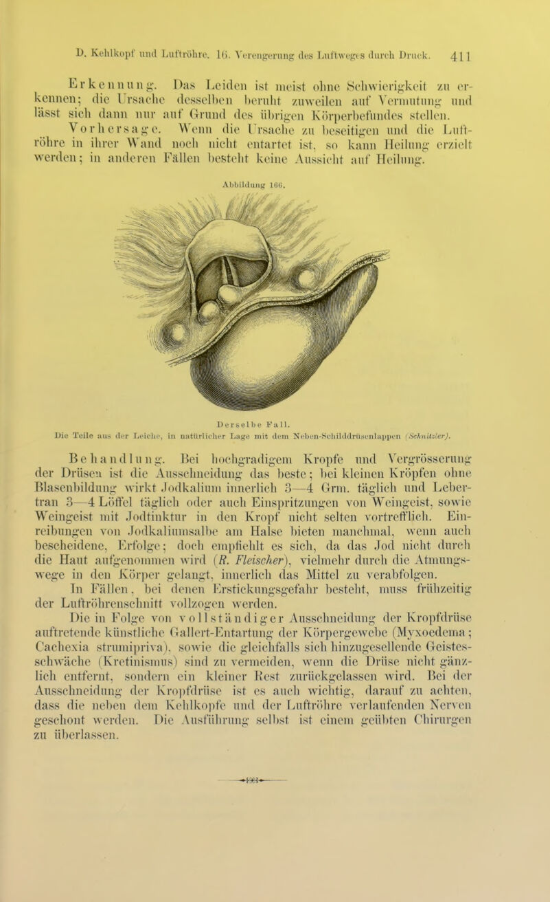 D. Ki'hlkopf inul Luftröhre. Vi-rfUfrcning des Liiftwi-fr»s fliirch Druck. 41 ] Erkennun«;-. Das Leiden ist meist ohne Sehwieri^keit zu er- kennen; die Ursaelie desselben herulit zuweilen auf Vernnitim^- und lässt sich dann nur auf Grund des übrigen Kör])erbefundes stellen. Vorhersage. Wenn die l'rsaclie zu beseitigen und die Lutt- röhre in ihrer Wand noch nieht entartet ist, so kann Heilung erzielt werden; in anderen Fällen besteht keine Aussieht auf Heilung. Abbildung 16G. Derselbe Fiill. Die Teile aus der Leiche, in niitiirliclier Lui?e mit dem Neben-SoliiUldriisenlaiipen (Schnitder). Behandlung. Bei hoehgradigcni Kröpfe und W'rgrösserung der Drüsen ist die Aussehneidung das beste; bei kleinen Kröpfen ohne Blasenbildung wirkt Jodkalium innerlich 3—4 Grni. täglich und Leber- tran 3—4 Löffel täglich oder auch Einspritzungen von Weingeist, sowie Weingeist mit Jodtinktur in den Kropf nicht selten vortrciflich. Ein- reibungen von .Iodkaliumsall)e am Halse bieten manchmal, wenn auch bescheidene, Erfolge; doch emptichlt es sich, da das Jod nicht durch die Haut aufgenommen wird (R. Fleischer), vielmehr durch die Atmuugs- wege in den Kör])er gelangt, innerlich das Mittel zu verabfolgen. In Fällen, bei denen Erstickungsgefahr besteht, nuiss frühzeitig der Luftröhrenschnitt vollzogen werden. Die in Folge von vollständiger Ausschneidung der Kropfdrüse auftretende künstliche Gallert-Entartung der Körpergewebe (Myxoedema; Cachexia strumipriva). sowie die gleichfalls sich hinzugesellende Geistes- schwäche (Kretinismus) sind zu vernuMden, wenn die Drüse nicht gänz- lich entfernt, sondern ein kleiner Kest zurückgelassen wird. Bei der Ausschneidung der Kro|)fdrüse ist es auch wichtig, darauf zu achten, dass die neben dem Kehlko))fe und der Luftr(»hre verlaufenden Nerven geschont werden. Die Ausführung selbst ist einem geübten Chirurgen zu überlassen.