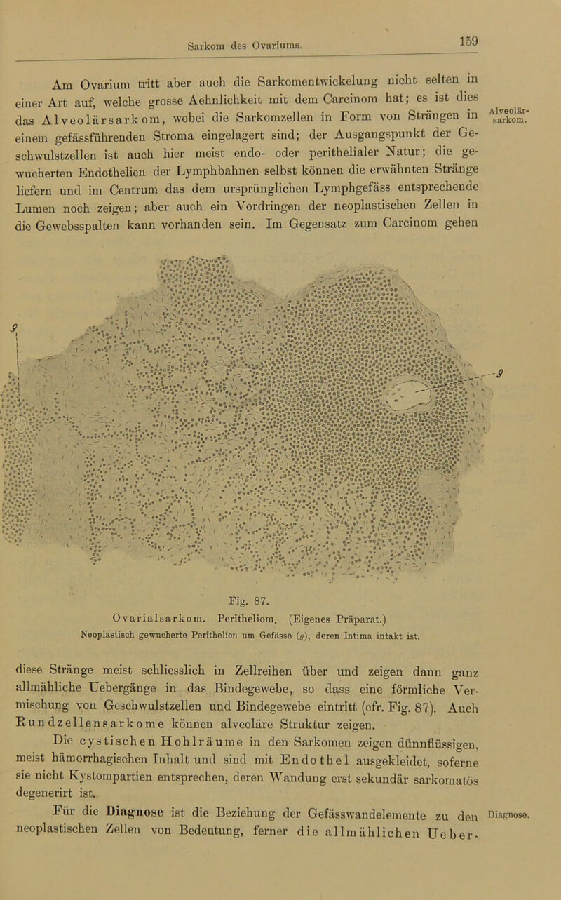 Am Ovarium tritt aber auch die Sarkomentwickelung nicht selten in einer Art auf, welche grosse Aehnlichkeit mit dem Carcinom hat; es ist dies das Alveolärsarkom, wobei die Sarkomzellen in Form von Strängen sarkom. einem gefässführenden Stroma eingelagert sind; der Ausgangspunkt der Ge- schwulstzellen ist auch hier meist endo- oder perithelialer Natur; die ge- wucherten Endothelien der Lymphbahnen selbst können die erwähnten Stränge liefern und im Centrum das dem ursprünglichen Lymphgefäss entsprechende Lumen noch zeigen; aber auch ein Vordringen der neoplastischen Zellen in die Gewebsspalten kann vorhanden sein. Im Gegensatz zum Carcinom gehen »•” * ** »1‘s v°»V« VV'V/VoV’co’o*. 4 0 fl cflV*eoO „ 0°, 04°°C*°.o°*o% o • °* • •... ' •• I * e • . v . * V'.if:c-.-V - »• /••V * .r.c j » e* « e • 6 « < / . • »v **0 1 , « o •  / *0 • O* • *0 * ’ # 0 0 • G:CvV 0 varialsarkom. Fig. 87. Peritheliom. (Eigenes Präparat.) Neoplaslisch gewucherte Perithelien um Gefässe (g), deren Intima intakt ist. diese Stränge meist schliesslich in Zellreihen über und zeigen dann ganz allmähliche Uebergänge in das Bindegewebe, so dass eine förmliche Ver- mischung von Geschwulstzellen und Bindegewebe eintritt (cfr. Fig. 87). Auch Rundzellensarkome können alveoläre Struktur zeigen. Die cystischen Hohlräume in den Sarkomen zeigen dünnflüssigen, meist hämorrhagischen Inhalt und sind mit Endothel ausgekleidet, soferne sie nicht Kystompartien entsprechen, deren Wandung erst sekundär sarkomatös degenerirt ist. Für die Diagnose ist die Beziehung der Gefässwandelemente zu den Diagnose, neoplastischen Zellen von Bedeutung, ferner die allmählichen Ueber-