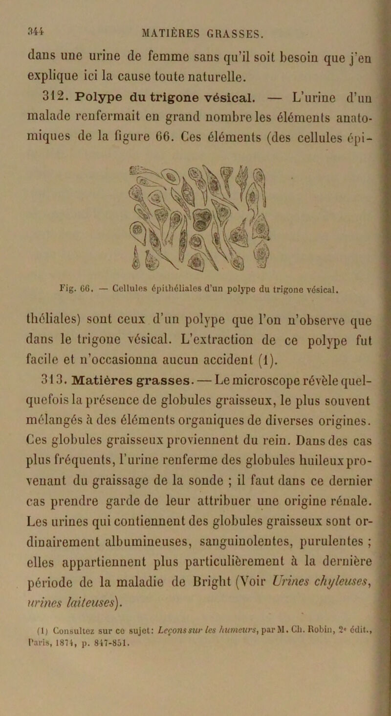 dans une urine de femme sans qu’il soit besoin que j’en explique ici la cause toute naturelle. 312. Polype du trigone vésical. — L’urine d’un malade renfermait en grand nombre les éléments anato- miques de la figure 06. Ces éléments (des cellules épi- théliales) sont ceux d’un polype que l’on n’observe que dans le trigone vésical. L’extraction de ce polype fut facile et n’occasionna aucun accident (1). 313. Matières grasses. — Le microscope révèle quel- quefois la présence de globules graisseux, le plus souvent mélangés à des éléments organiques de diverses origines. Ces globules graisseux proviennent du rein. Dans des cas plus fréquents, l’urine renferme des globules huileux pro- venant du graissage de la sonde ; il faut dans ce dernier cas prendre garde de leur attribuer une origine rénale. Les urines qui contiennent des globules graisseux sont or- dinairement albumineuses, sanguinolentes, purulentes ; elles appartiennent plus particulièrement à la dernière période de la maladie de Bright (Voir Urines chyleuses, urines laiteuses). Fig. 66. — Cellules épithéliales d’un polype du trigone vésical. (1) Consultez sur ce sujet: Leçonssur tes /tumeurs, par M. Ch. Robin, 2e édit., Paris, 1874, p. 847-851.