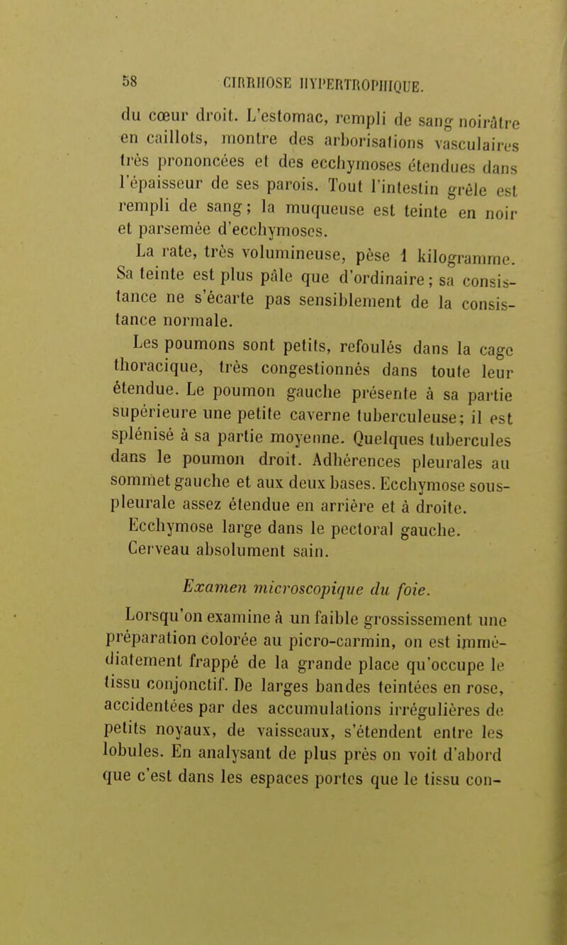 du cœur droit. L'estomac, rempli de sang noirâtre en caillots, niontre des arborisations vaseulaires très prononcées et des ecchymoses étendues dans l'épaisseur de ses parois. Tout l'intestin grêle est rempli de sang ; la muqueuse est teinte en noir et parsemée d'ecchymoses. La rate, très volumineuse, pèse i kilogramme. Sa teinte est plus pâle que d'ordinaire ; sa consis- tance ne s'écarte pas sensiblement de la consis- tance normale. Les poumons sont petits, refoulés dans la cage thoracique, très congestionnés dans toute leur étendue. Le poumon gauche présente à sa partie supérieure une petite caverne tuberculeuse; il est splénisé à sa partie moyenne. Quelques tubercules dans le poumon droit. Adhérences pleurales au sommet gauche et aux deux bases. Ecchymose sous- pleurale assez étendue en arrière et à droite. Ecchymose large dans le pectoral gauche. Cerveau absolument sain. Examen microscopique du foie. Lorsqu'on examine h un faible grossissement une préparation colorée au picro-carmin, on est immé- diatement frappé de la grande place qu'occupe le tissu conjonctif. De larges bandes teintées en rose, accidentées par des accumulations irrégulières de petits noyaux, de vaisseaux, s'étendent entre les lobules. En analysant de plus prés on voit d'abord que c'est dans les espaces portes que le tissu con-