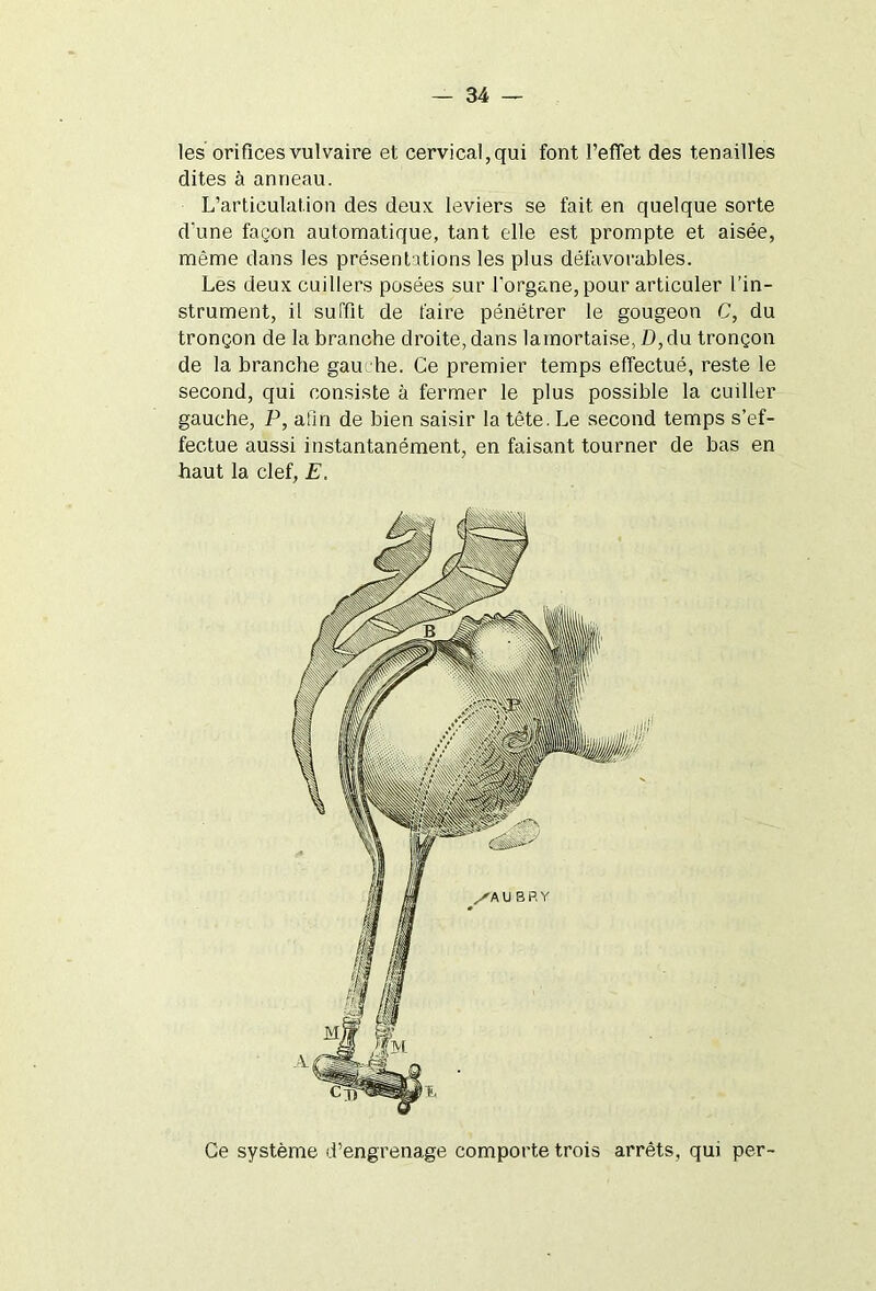 les orifices vulvaire et cervical, qui font l’effet des tenailles dites à anneau. L’articulation des deux leviers se fait en quelque sorte d’une façon automatique, tant elle est prompte et aisée, même dans les présentations les plus défavorables. Les deux cuillers posées sur l’organe, pour articuler l’in- strument, il suffit de faire pénétrer le gougeon C, du tronçon de la branche droite, dans lainortaise, D, du tronçon de la branche gauche. Ce premier temps effectué, reste le second, qui consiste à fermer le plus possible la cuiller gauche, P, afin de bien saisir la tête. Le second temps s’ef- fectue aussi instantanément, en faisant tourner de bas en haut la clef, E. Ce système d’engrenage comporte trois arrêts, qui per-