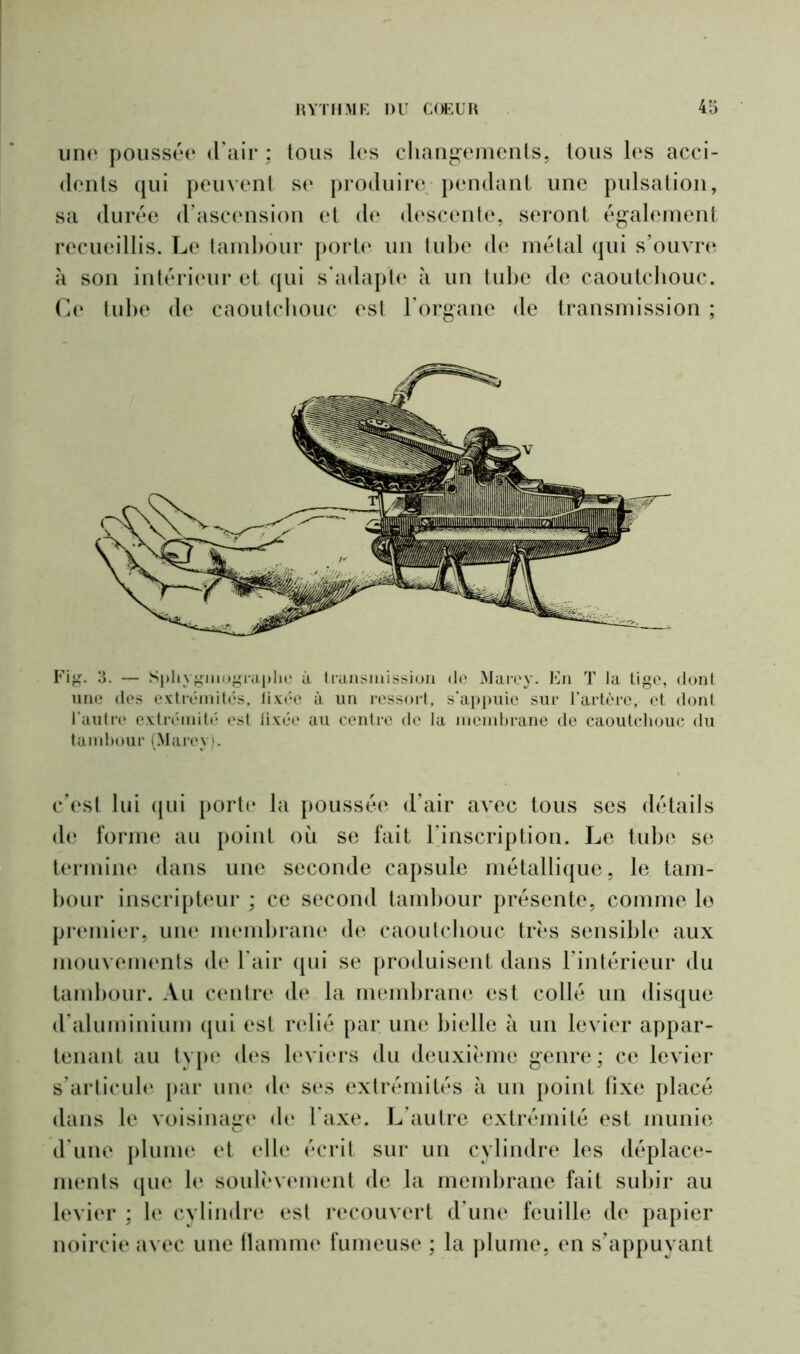 une poussée d’air ; tous les changements, tous les acci- dents qui peuvent se produire pendant une pulsation, sa durée d’ascension et de descente, seront également recueillis. Le tambour porte un tube de métal qui s’ouvre à son intérieur et qui s’adapte à un tube de caoutchouc. Ce tube de caoutchouc est l’organe de transmission ; Fig. 3. — Spliygmographe à transmission de Marey. En T Ja tige, dont une des extrémités, îixée à un ressort, s'appuie sur l’artère, et dont l'autre extrémité est fixée au centre de la membrane de caoutchouc du tambour (Marey). c’est lui qui porte la poussée d’air avec tous ses détails de forme au point où se fait l’inscription. Le tube se termine dans une seconde capsule métallique, le tam- bour inscripteur ; ce second tambour présente, comme le premier, une membrane de caoutchouc très sensible aux mouvements de l’air qui se produisent dans l’intérieur du tambour. Au centre de la membrane est collé un disque d’aluminium qui est relié par une bielle à un levier appar- tenant au type des leviers du deuxième genre; ce levier s’articule par une de ses extrémités à un point fixe placé dans le voisinage de l’axe. L’autre extrémité est munie d’une plume et elle écrit sur un cylindre les déplace- ments que le soulèvement de la membrane fait subir au levier ; le cylindre est recouvert d’une feuille de papier noircie avec une flamme fumeuse ; la plume, en s’appuyant