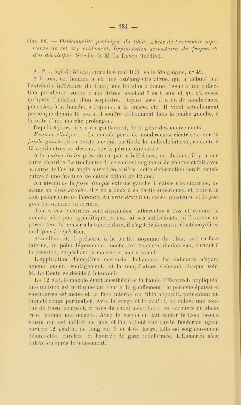 Ohs. 88. — Oslcoinyélite prolongée du tibia. Abcès de re.rtréinitc supé- rieure de cet os; évidenieut. Imphinlaiion secoiiduire de fragments d'os décalcifiés. Sorvice de M. Le Dentu (Inédite). A. P..., âgé de 32 ans, entre le G mai 1891, salle Malgaig-ne, n« 48. A 11 ans, cet homme a ou une ostéomyélite aiguë, qui a débuté par l'extrémité inférieure du tibia; une incision a donné l'issue à une collec- tion purulente, suivie d'unt; fistule pendant 7 ou 8 ans, et qui n'a cessé qu'après l'ablation d'un séquestre. Depuis lors il a eu de nombreuses poussées, à la hanche, à l'épaule, à la cuisse, etc. Il vient actuellement parce que depuis 15 jours, il soufTrc violemment dans la jambe gauche, à la suite d'une marche prolongée. Depuis 8 jours, il y a du gonflement, de la gêne des mouvements. Examen clinùiue. — Le malade porte de nombreuses cicatrices ; sur la jambe gauche, W en existe une qui, partie de la malléole interne, remonte à 15 centimètres au-dessus; sur le péroné une autre. A la cuisse droite près de sa partie inférieure, en dedans, il y a une autre cicatrice. Le trochanter de ce côté est augmenté de volume et fait avec le corps de l'os un angle ouvert en arrière ; cette déformation serait consé- cutive à une fracture de cuisse datant de 12 ans. Au niveau de la fosse iliaciue externe gauche il existe une cicatrice, de môme au bras gauche, il y en a deux à sa partie supérieure, et trois à la face postérieure de Vépaule. Au bras droit il en existe plusieurs, et le poi- gnet est subluxé en arrière. Toutes ces cicatrices sont déprimées, adhérentes à l'os et comme le malade n'est pas syphilitique, et que ni ses antécédents, ni l'examen ne permettent de penser à la tuberculose, il s'agit évidemment d'ostéomyélites nudtiples à répétition. Actuellement, il présente à la partie moyenne du tibia, sur sa face interne, un point légèrement tuméfié, extrêmement douloureux, surtout à la pression, empêchant la marche et tout sommeil. L'application d'emplâtre mercuriel belladoné, les calmants n'ayant amené aucun soulagement, et la température s'élevant chaque soir, M. Le Dentu se décide à intervenir. Le 12 mai, le malade étant anesthésié et la bande d'Esmarch appliquée, une incision est pratiquée au centre du gonflement ; le périoste épaissi et vascularisé est incisé et la fiioe interne du tibia apparaît, présentant un piqueté rouge particulier. Avec la gouge et l- nr^illc!, o:i enlève une cou- che de tissu compact, et près du canal mr'(li:ll,iii\\ on découvre un abcès gros comme une noisette. Avec le ciseau on f.iit s:uii.'r le tissu osseux voisin qui est infiltré de pus, et l'on obtient une cavité fusiforme ayant environ 12 ceiitim. de long «ur 3 ou 4 de large. Elle est soigneusement d('sinfect(''e, curettée et bourrée de gaze iodoformée. L'Esmarch n'est enlevé (pi'iiprès le pansement.