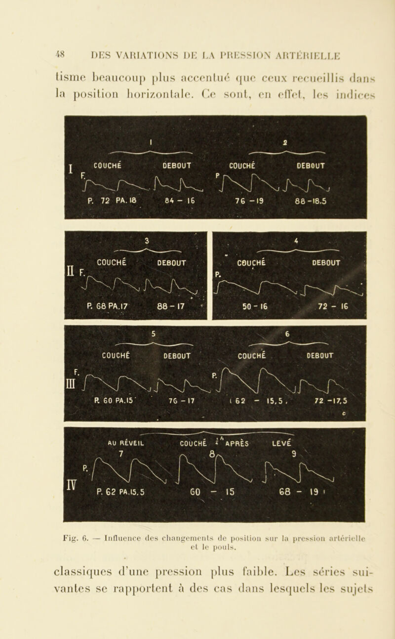 tisme beaucoup plus accentué que ceux recueillis dans la position horizontale. Ce sont, en effet, les indices t COUCHÉ F. P. 72 PA. 18 DEBOUT COUCHE P r\ r 84 - 16 76 -19 DEBOUT 88 -18.5 3 * COUCHÉ DEBOUT n f. P. 68 PA.17 88-17 4 «• COUCHÉ DEBOUT P. -J ^ 50 - 16 72 - 16 COUCHÉ DEBOUT COUCHE DEBOUT R 60 PA.15' 76 - 17 ' • .r J'- (62 - 15,5/ 72 -17,5 Fig. 6. — Influence des changements de position sur la pression artérielle et le pouls. classiques d’une pression plus faible. Les séries sui- vantes se rapportent à des cas dans lesquels les sujets