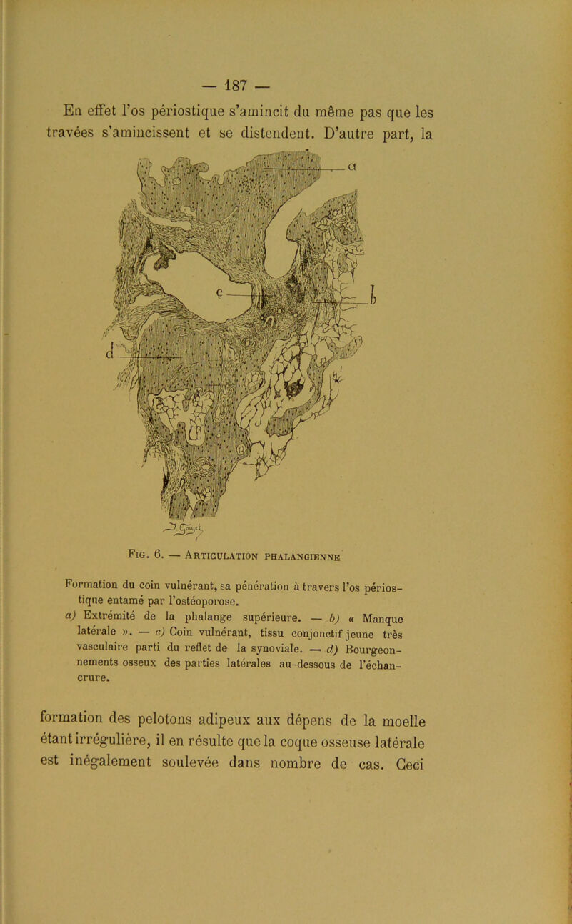 Ea effet l’os periostique s’amincit da m<3me pas que les travees s’amincissent et se distendent. D’autre part, la t, Fig. 6. — Articulation phalangienne Formation du coin vulnerant, sa peneration a travers l’os perios- tique entame par l’osteoporose. a) Extremite de la phalange superieure. — b) « Manque laterale ». — c) Coin vulnerant, tissu conjonctif jeune tres vasculaire parti du reflet de la synoviale. — d) Bourgeon- nements osseux des parties laterales au-dessous de l’echan- crure. formation des pelotons adipeux aux depens de la moelle etantirreguliere, il en resulte que la coque osseuse laterale est inegalement soulevee dans nombre de cas. Geci