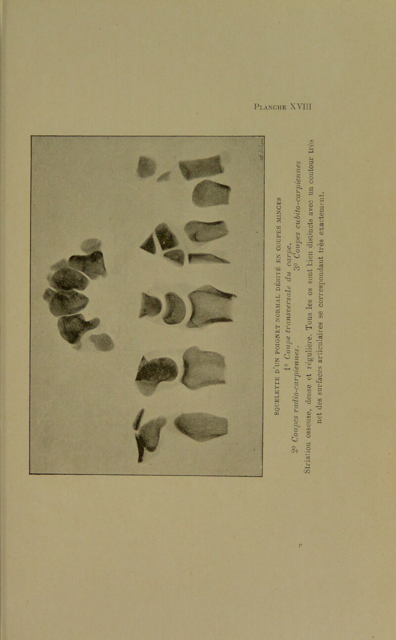 •O u O Z s CO w a. 3 o o 25 w - •w i 3 Q J « IS Co P5 S> o «o 25 S 53 H rt to Z <*> 0 O a. o z O p o Q TH . W H H H H Ld a I i o s Co s s o O 0 r Strialion osseuse, dense et reguliere. Tous les os sont bien distincts avec un contour tres net des surfaces articulaires se correspondant tres exactement.