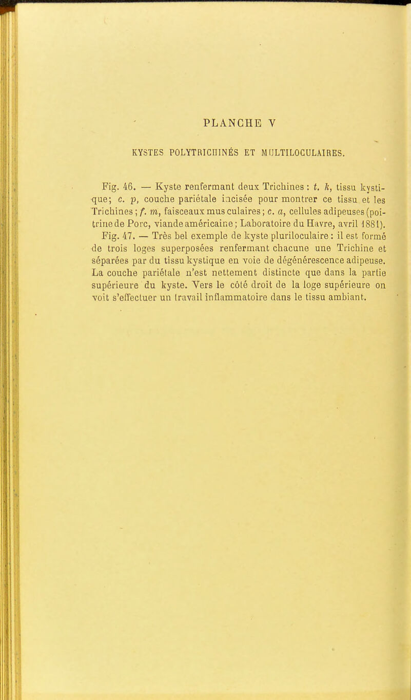 KYSTES POLYTRICniNÉS ET MIJLTILOCULAIRES. Fig. 46. — Kyste renfermant deux Trichines : t. k, tissu kysti- que; c. p, couche pariétale incisée pour montrer ce tissu et les Trichines ; f. m, faisceaux mus culaires ; c. a, cellules adipeuses (poi- trinede Porc, viande américaine; Laboratoire du Havre, avril i881). Fig. 47. — Très bel exemple de kyste pluriloculaire : il est Formé de trois loges superposées renfermant chacune une Trichine et séparées par du tissu kystique en voie de dégénérescence adipeuse. La couche pariétale n'est nettement distincte que dans la partie supérieure du kyste. Vers le côlé droit de la loge supérieure on voit s'effectuer un travail inflammatoire dans le tissu ambiant.