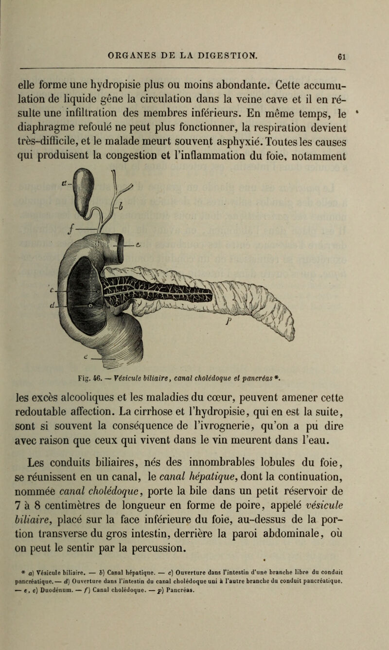 elle forme une hydropisie plus ou moins abondante. Cette accumu- lation de liquide gêne la circulation dans la veine cave et il en ré- sulte une infiltration des membres inférieurs. En même temps, le diaphragme refoulé ne peut plus fonctionner, la respiration devient très-difficile, et le malade meurt souvent asphyxié. Toutes les causes qui produisent la congestion et l’inflammation du foie, notamment Fig. 46. — Vésicule biliaire, canal cholédoque et pancréas*. les excès alcooliques et les maladies du cœur, peuvent amener cette redoutable affection. La cirrhose et l’hydropisie, qui en est la suite, sont si souvent la conséquence de l’ivrognerie, qu’on a pu dire avec raison que ceux qui vivent dans le vin meurent dans l’eau. Les conduits biliaires, nés des innombrables lobules du foie, se réunissent en un canal, le canal hépatique, dont la continuation, nommée canal cholédoque, porte la bile dans un petit réservoir de 7 à 8 centimètres de longueur en forme de poire, appelé vésicule biliaire, placé sur la face inférieure du foie, au-dessus de la por- tion transverse du gros intestin, derrière la paroi abdominale, où on peut le sentir par la percussion. * a) Vésicule biliaire. — 5) Canal hépatique. — c) Ouverture dans l’intestin d’une branche libre du conduit pancréatique.— d) Ouverture dans l’intestin du canal cholédoque uni à l'autre branche du conduit pancréatique. — t, e) Duodénum. — f) Canal cholédoque. —j>) Pancréas.