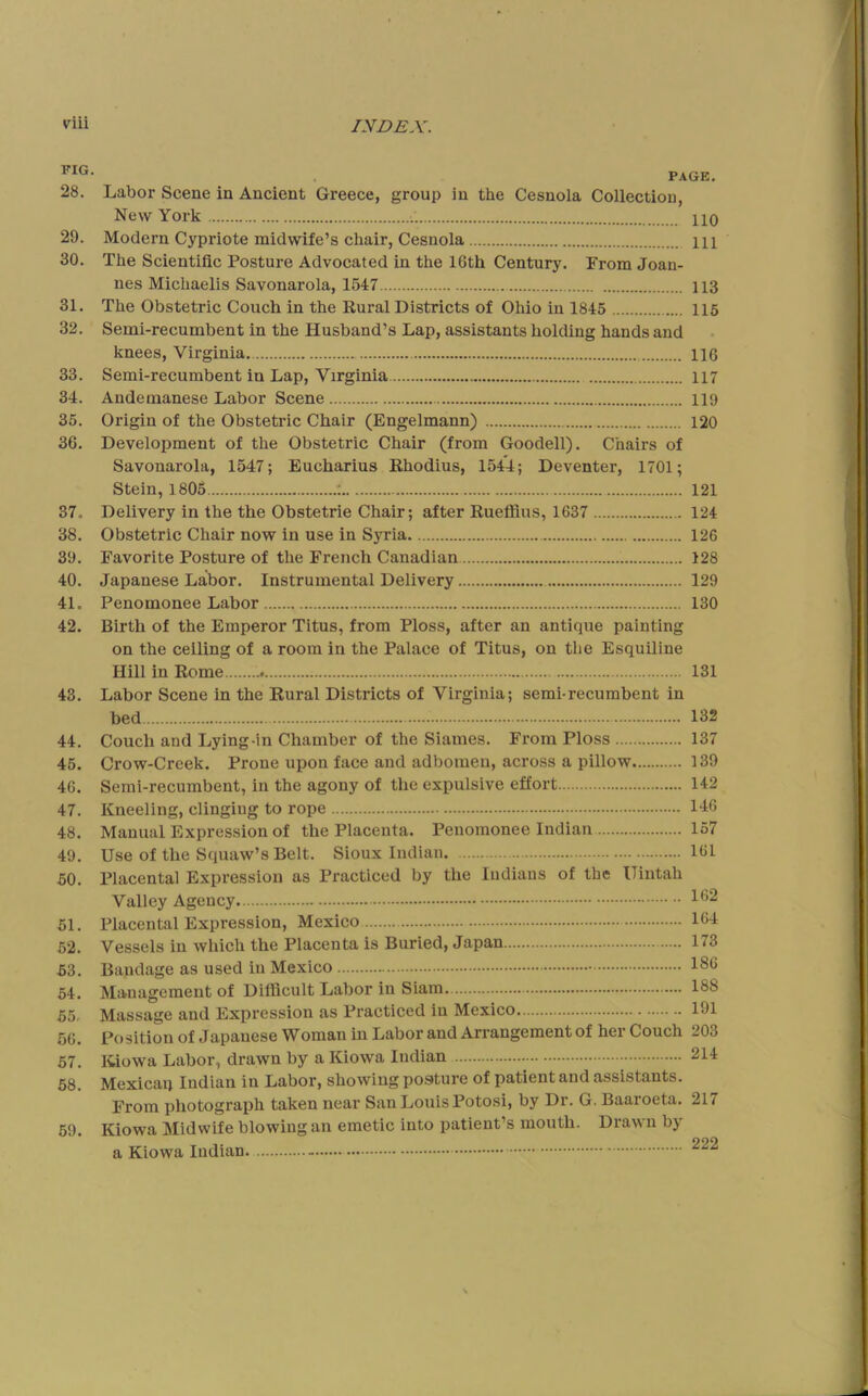 FIG. 28. 29. 30. 31. 32. 33. 34. 35. 36. 37. 38. 39. 40. 41. 42. 43. 44. 45. 46. 47. 48. 49. 50. 51. 52. 53. 54. 55. 66. 57. 58. 59. • X Avjrni • Labor Scene in Ancient Greece, group in the Cesnola Collection, New York HO Modern Cypriote midwife’s chair, Cesnola HI The Scientific Posture Advocated in the 16th Century. From Joan- nes Michaelis Savonarola, 1547 113 The Obstetric Couch in the Kural Districts of Ohio in 1845 115 Semi-recumbent in the Husband’s Lap, assistants holding hands and knees, Virginia. H6 Semi-recumbent in Lap, Virginia 117 Andemanese Labor Scene 119 Origin of the Obstetric Chair (Engelmann) 120 Development of the Obstetric Chair (from Goodell). Chairs of Savonarola, 1547; Eucharius Rhodius, 1544; Deventer, 1701; Stein, 1805 ; 121 Delivery in the the Obstetrie Chair; after Ruefiius, 1637 124 Obstetric Chair now in use in Syria 126 Favorite Posture of the French Canadian 128 Japanese Labor. Instrumental Delivery 129 Penomonee Labor 130 Birth of the Emperor Titus, from Ploss, after an antique painting on the ceiling of a room in the Palace of Titus, on the Esquiline Hill in Rome 131 Labor Scene in the Rural Districts of Virginia; semi-recumbent in bed Couch and Lying-in Chamber of the Siames. From Ploss Crow-Creek. Prone upon face and adbomen, across a pillow Semi-recumbent, in the agony of the expulsive effort Kneeling, clinging to rope Manual Expression of the Placenta. Penomonee Indian Use of the Squaw’s Belt. Sioux Indian. Placenta] Expression as Practiced by the Indians of the Uintah Valley Agency Placental Expression, Mexico Vessels in which the Placenta is Buried, Japan Bandage as used in Mexico Management of Ditficult Labor in Siam. Massage and Expression as Practiced in Mexico Position of Japanese Woman in Labor and Arrangement of her Couch Kiowa Labor, drawn by a Kiowa Indian Mexicaq Indian in Labor, showing posture of patient and assistants. From photograph taken near San Loiais Potosi, by Dr. G. Baaroeta. Kiowa Midwife blowing an emetic into patient’s mouth. Drawn by a Kiowa Indian. 132 137 139 142 146 157 161 162 164 173 186 188 191 203 214 217 222