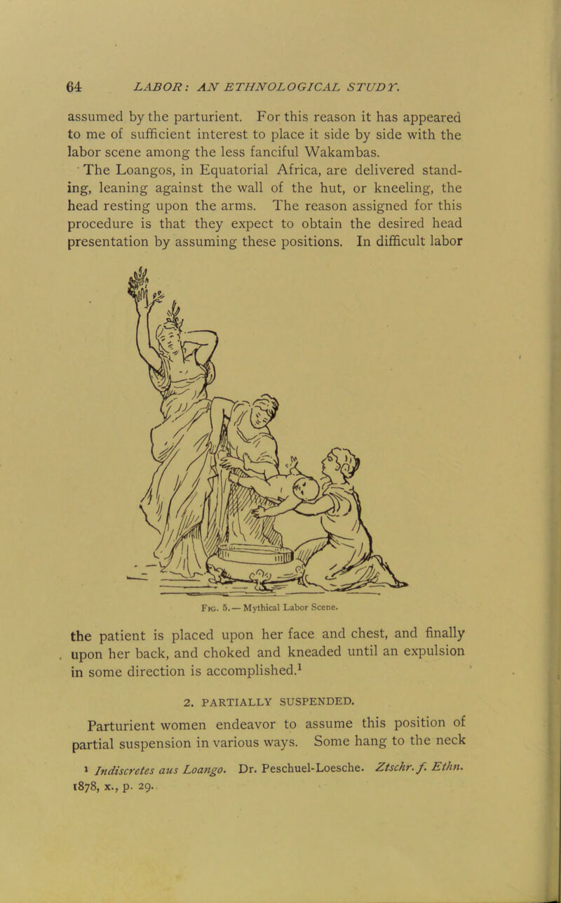 assumed by the parturient. For this reason it has appeared to me of sufficient interest to place it side by side with the labor scene among the less fanciful Wakambas. ■ The Loangos, in Equatorial Africa, are delivered stand- ing, leaning against the wall of the hut, or kneeling, the head resting upon the arms. The reason assigned for this procedure is that they expect to obtain the desired head presentation by assuming these positions. In difficult labor the patient is placed upon her face and chest, and finally . upon her back, and choked and kneaded until an expulsion in some direction is accomplished.^ 2. PARTIALLY SUSPENDED. Parturient women endeavor to assume this position of partial suspension in various ways. Some hang to the neck 1 Indiscretes aus Loango. Dr. Peschuel-Loesche. Ztschr.f. Ethn. 1878, X., p. 29.