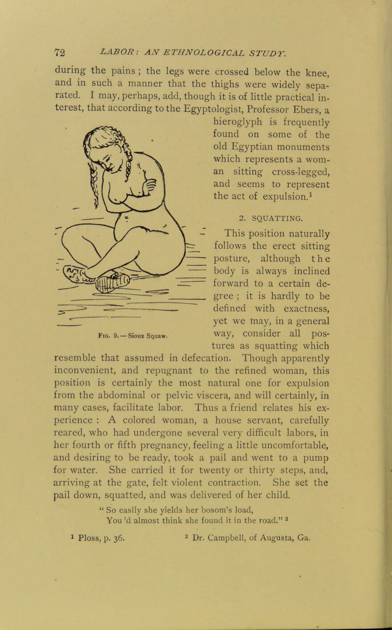 during the pains ; the legs were crossed below the knee, and in such a manner that the thighs were widely sepa- rated. I may, perhaps, add, though it is of little practical in- terest, that according to the Egyptologist, Professor Ebers, a hieroglyph is frequently found on some of the old Egyptian monuments which represents a wom- an sitting cross-legged, and seems to represent the act of expulsion.^ 2. SQUATTING. This position naturally follows the erect sitting posture, although the body is always inclined forward to a certain de- gree ; it is hardly to be defined with exactness, yet we may, in a general way, consider all pos- tures as squatting which resemble that assumed in defecation. Though apparently inconvenient, and repugnant to the refined woman, this position is certainly the most natural one for expulsion from the abdominal or pelvic viscera, and will certainly, in many cases, facilitate labor. Thus a friend relates his ex- perience : A colored woman, a house servant, carefully reared, who had undergone several very difficult labors, in her fourth or fifth pregnancy, feeling a little uncomfortable, and desiring to be ready, took a pail and went to a pump for water. She carried it for twenty or thirty steps, and, arriving at the gate, felt violent contraction. She set the pail down, squatted, and was delivered of her child. “ So easily she yields her bosom’s load, You’d almost think she found it in the road.” ^ Fig. 9. — Sioux Squaw.