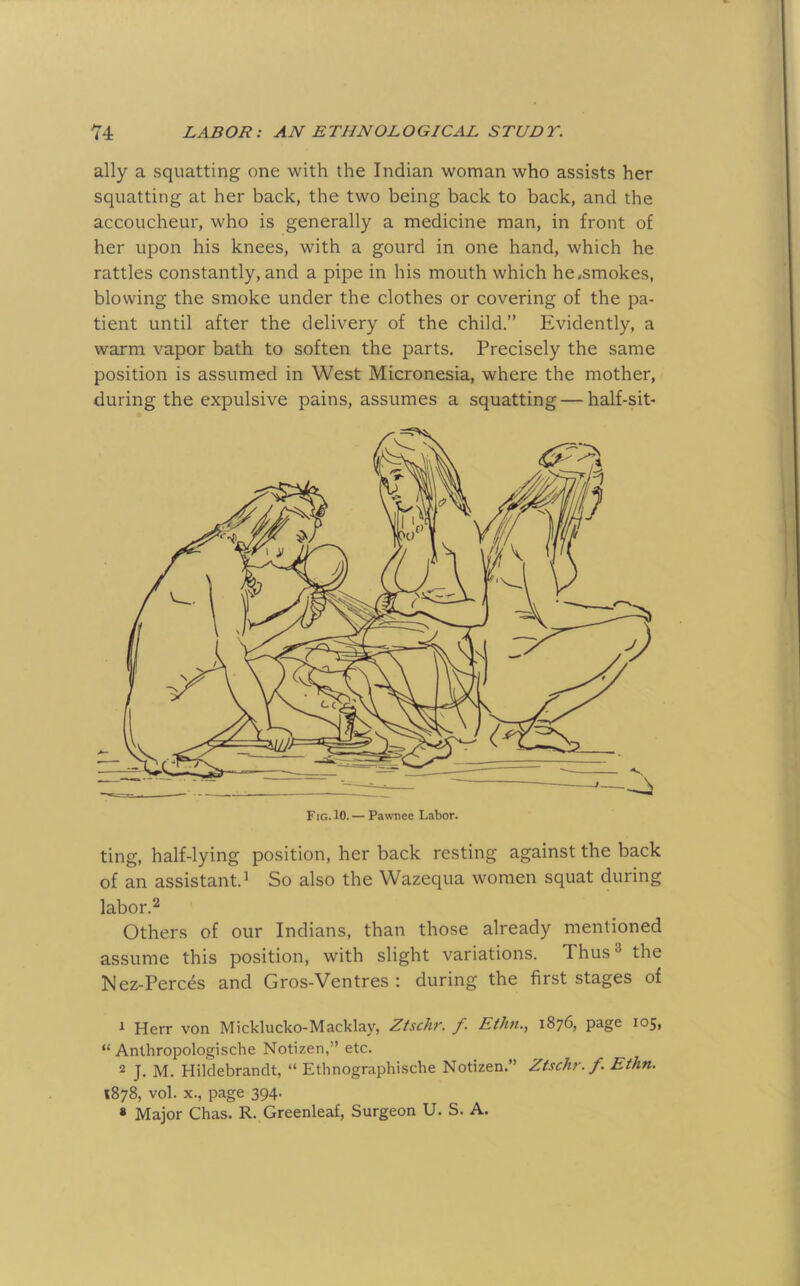 ally a squatting one with the Indian woman who assists her squatting at her back, the two being back to back, and the accoucheur, who is generally a medicine man, in front of her upon his knees, with a gourd in one hand, which he rattles constantly, and a pipe in his mouth which hCiSmokes, blowing the smoke under the clothes or covering of the pa- tient until after the delivery of the child.” Evidently, a warm vapor bath to soften the parts. Precisely the same position is assumed in West Micronesia, where the mother, during the expulsive pains, assumes a squatting — half-sit- labor.2 Others of our Indians, than those already mentioned assume this position, with slight variations. Thus ® the Nez-Perc^s and Gros-Ventres : during the first stages of ^ Herr von Micklucko-Macklay, Ztschr. f- Etlm., 1876, page 105, “ Anthropologische Notizen,” etc. 2 J. M. Hildebrandt, “ Ethnographische Notizen.” Ztschr. f. Ethn. 1878, vol. X., page 394. « Major Chas. R. Greenleaf, Surgeon U. S. A.