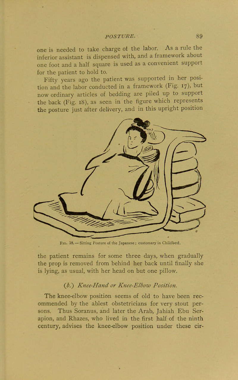 one is needed to take charge ot the labor. As a rule the inferior assistant is dispensed with, and a framework about one foot and a half square is used as a convenient support for the patient to hold to. Fifty years ago the patient was supported in her posi- tion and the labor conducted in a framework (Fig. I7)> but now ordinary articles of bedding are piled up to support the back (Fig. i8), as seen in the figure which represents the posture just after delivery, and in this upright position the patient remains for some three days, when gradually the prop is removed from behind her back until finally she is lying, as usual, with her head on but one pillow. (b.') Knee-Hand or Knee-Elbow Position. The knee-elbow position seems of old to have been rec- ommended by the ablest obstetricians for very stout per- sons. Thus Soranus, and later the Arab, Jahiah Ebu Ser- apion, and Rhazes, who lived in the first half of the ninth century, advises the knee-elbow position under these cir-