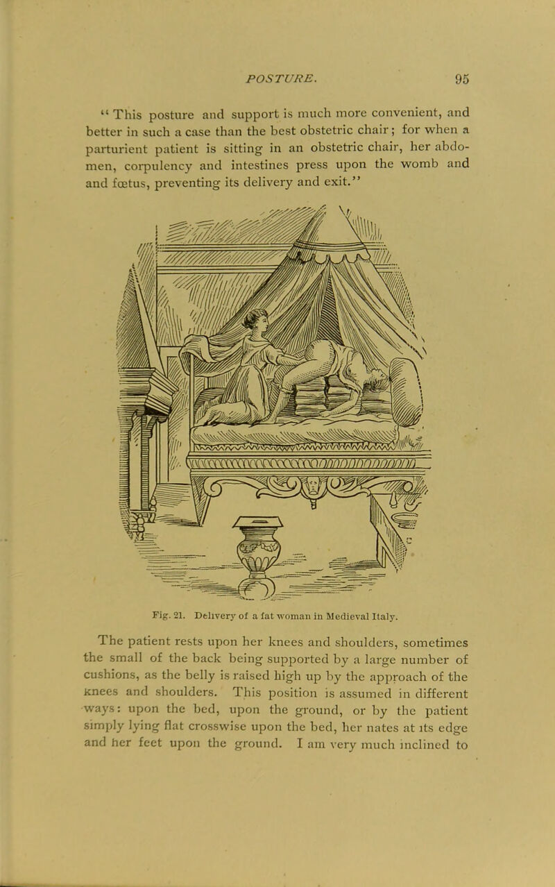 “ This posture and support is much more convenient, and better in such a case than the best obstetric chair; for when a parturient patient is sitting in an obstetric chair, her abdo- men, corpulency and intestines press upon the womb and and foetus, preventing its delivery and exit.” Fig. 21. Dtlivery of a fat woman in Medieval Italy. The patient rests upon her knees and shoulders, sometimes the small of the back being supported by a large number of cushions, as the belly is raised high up by the approach of the Knees and shoulders. This position is assumed in different ways: upon the bed, upon the ground, or by the patient simply lying flat crosswise upon the bed, her nates at its edge and her feet upon the ground. I am very much inclined to