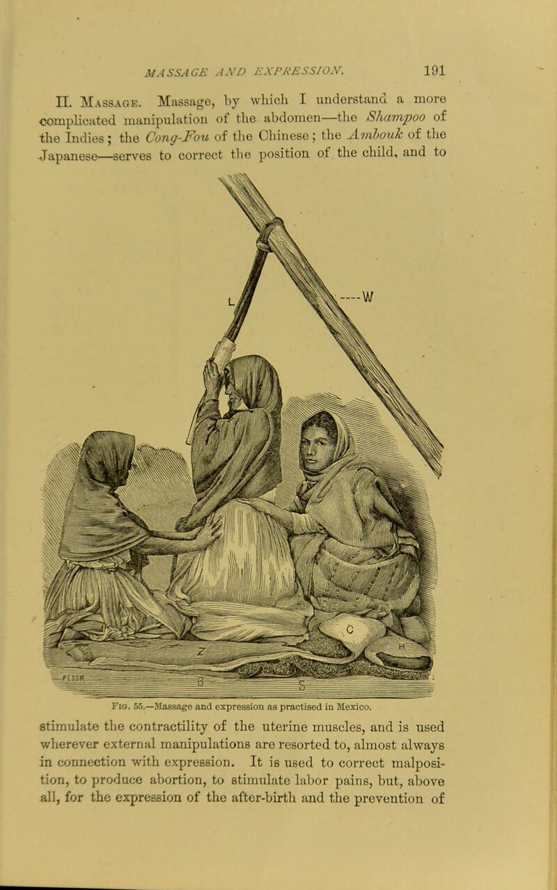 Fio. 55.—Massage and expression as practised in Mexico. Stimulate the contractility of the uterine muscles, and is used wherever external manipulations are resorted to, almost always in connection with expression. It is used to correct malposi- tion, to produce abortion, to stimulate labor pains, but, above all, for the expression of the after-birth and the prevention of iVASSAGE AiVn EXFA'ESS/O.V. 191 II. M.\ssactE. Massage, by which I understand a more complicated manipulation of the abdomen—the Shampoo of the Indies; the Coug-Fou of the Chinese; the A.itibouh of the Japanese—serves to correct the position ot the child, and to