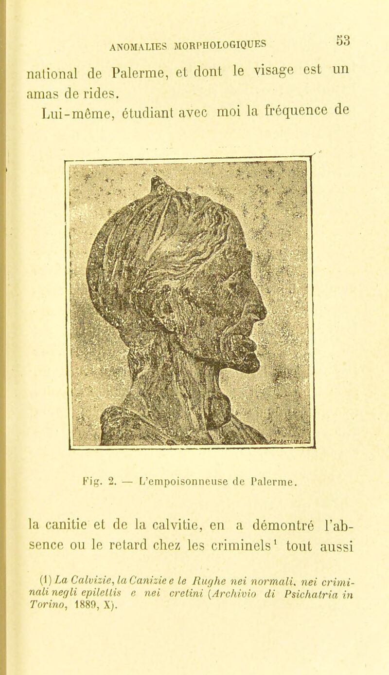 national de Palerme, et dont le visage est un amas de rides. Lui-même, étudiant avec moi la fréquence de t'ig. 2. — L'empoisonneuse de Palerme. la canitie et de la calvitie, en a démontré l'ab- sence ou le retard chez les criminels' tout aussi {i) La Calvizie, laCaniziee le Rughe nei normali. nei crimi- nali negli epilellis e nei crctini [Archivio di Psichairia in