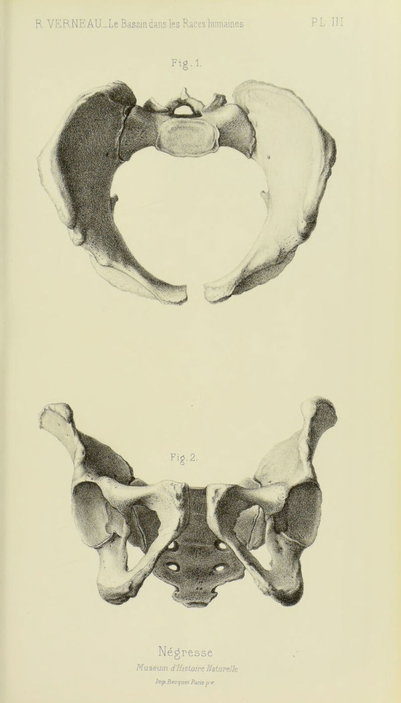 Fig.l. Négresse Muséum d Histoire Naturelle