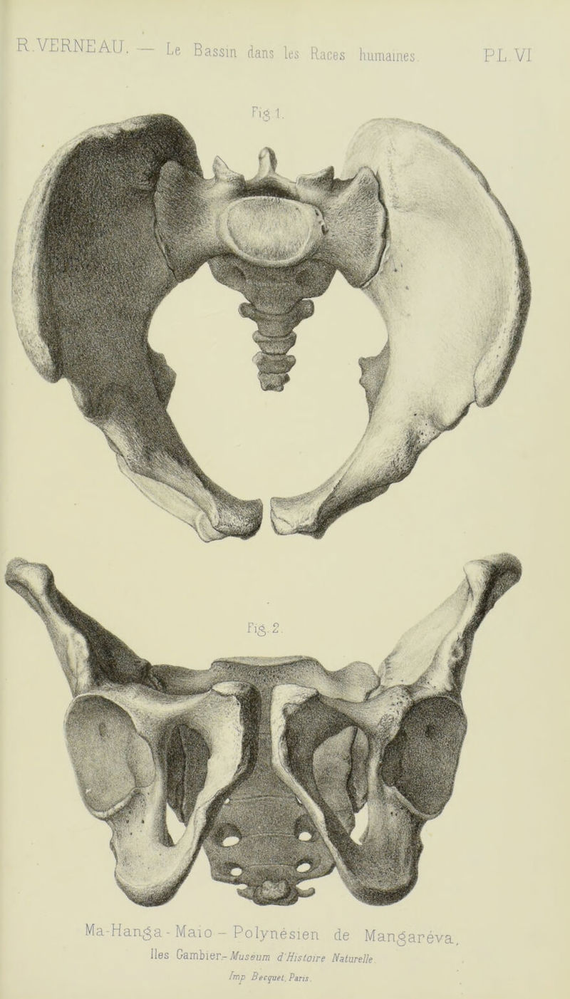 R.VERNEAU. — Le Bassin dans les Races humaines PL VI Ma-Hanga - Maio - Polynésien de Man^aréva, Iles Gambier.-#u5eu/72 dHistoire Naturelle fmp Becqvet, Pans.