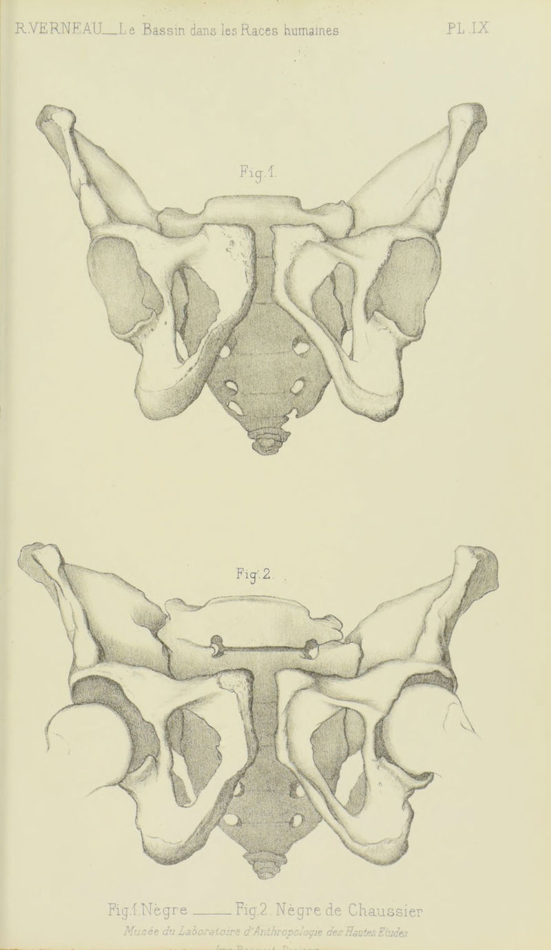 Figi.Nègre Fig.2 Nègre de Chaussier Musée du Laboratoire d‘Anthropologie des Hautes Eluder