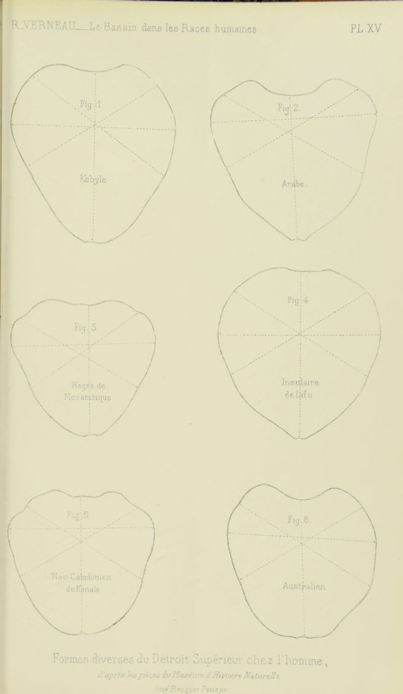 K ,\ ERNF.AIT—Le Bassin dans les Races humaines PL Formes diverses du Detroit Supérieur chez l'homme , les j?iè ses dv Muséum d'/fisioire I\fs tu relie hnp Becquet Farispx