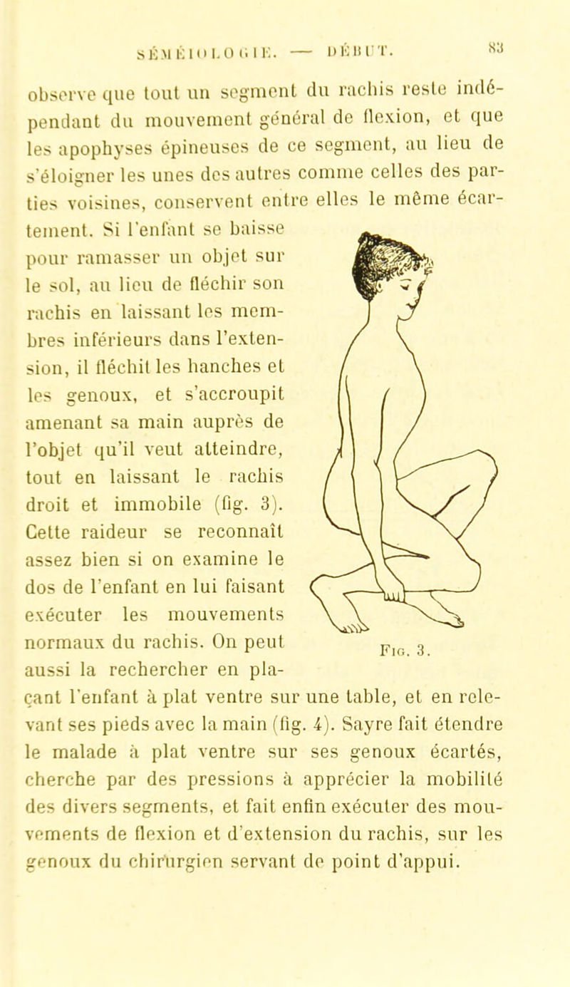 observe que tout un segment du rachis reste indé- pendant du mouvement général de flexion, et que les apophyses épineuses de ce segment, au lieu de s’éloigner les unes des autres comme celles des par- ties voisines, conservent entre elles le même écar- tement. Si lenlant se baisse pour ramasser un objet sur le sol, au lieu de fléchir son rachis en laissant les mem- bres inférieurs dans l’exten- sion, il fléchit les hanches et les genoux, et s’accroupit amenant sa main auprès de l’objet qu’il veut atteindre, tout en laissant le rachis droit et immobile (fig. 3). Cette raideur se reconnaît assez bien si on examine le dos de l’enfant en lui faisant exécuter les mouvements normaux du rachis. On peut aussi la rechercher en pla- çant l'enfant à plat ventre sur une table, et en rele- vant ses pieds avec la main (fig. 4). Sayre fait étendre le malade à plat ventre sur ses genoux écartés, cherche par des pressions à apprécier la mobililé des divers segments, et fait enfin exécuter des mou- vements de flexion et d’extension du rachis, sur les genoux du chirurgien servant de point d’appui.