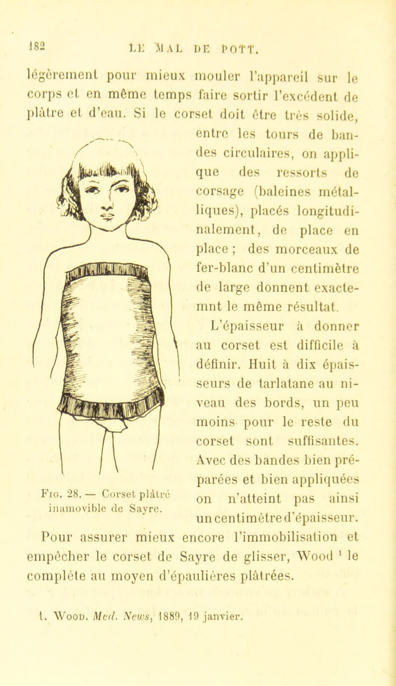 LL 51 AL DK t> 0 T T. légèrement pour mieux mouler l’appareil sur le corps cl en môme temps faire sortir l’excédent de plâtre et d’eau. Si le corset doit être très solide, entre les tours de ban- des circulaires, on appli- que des ressorts de corsage (baleines métal- liques), placés longitudi- nalement, de place en place ; des morceaux de fer-blanc d’un centimètre de large donnent exacte- mnt le même résultat. L’épaisseur à donner au corset est difficile à définir. Huit à dix épais- seurs de tarlatane au ni- veau des bords, un peu moins pour le reste du corset sont suffisantes. Avec des bandes bien pré- parées et bien appliquées on n’atteint pas ainsi un centimètre d’épaisseur. Fig. 28.— Corset plâtré inamovible de Sayre. Pour assurer mieux encore l’immobilisation et empêcher le corset de Sayre de glisser, Wood 1 le complète au moyen d’épaulières plâtrées. t. Wooü. Med. News, 1881), 19 janvier.