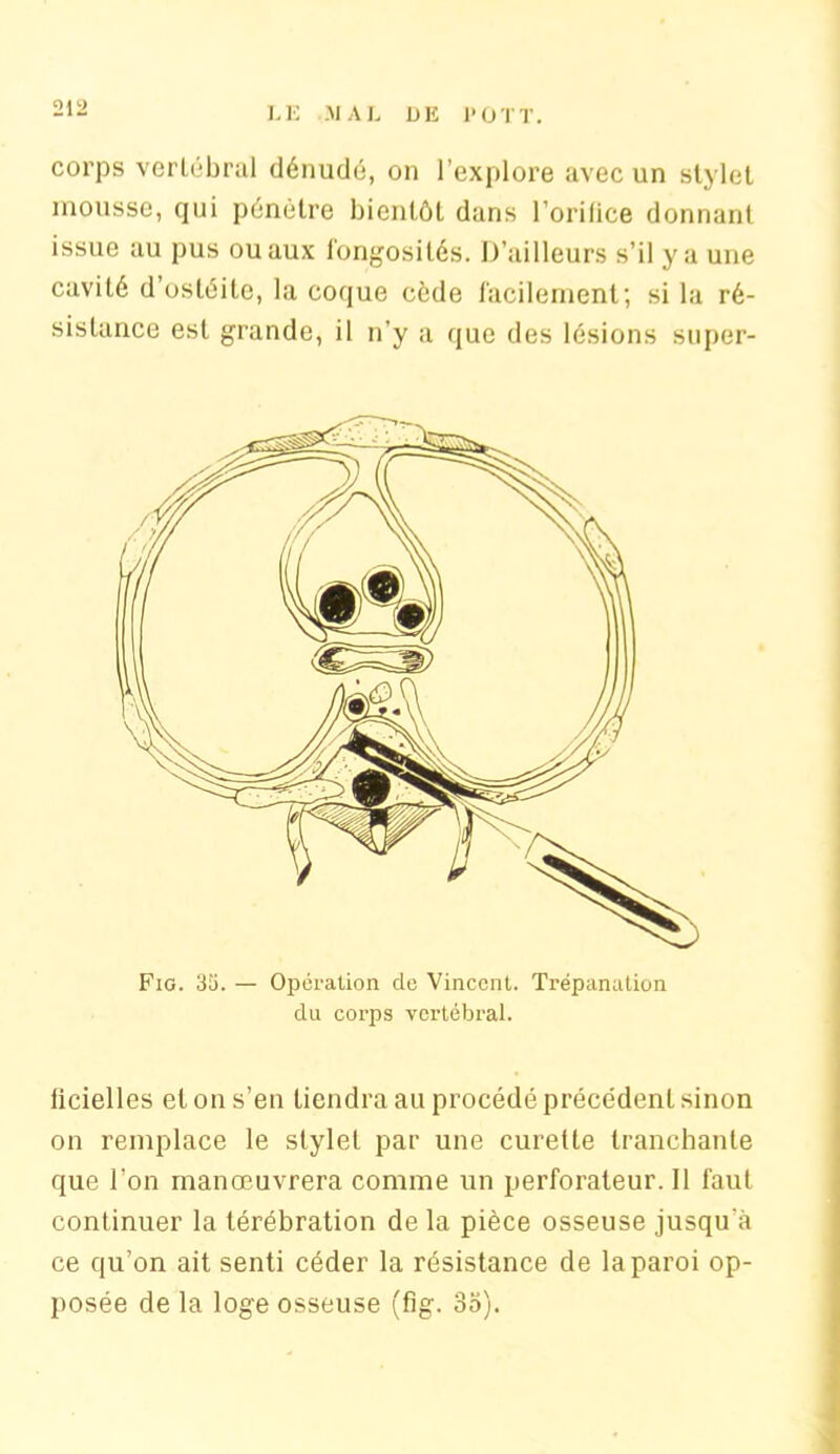 corps vertébral dénudé, on l’explore avec un stylet mousse, cjui pénètre bientôt dans l’orifice donnant issue au pus ou aux fongosités. D’ailleurs s’il y a une cavité d’ostéite, la coque cède facilement; si la ré- sistance est grande, il n’y a que des lésions super- Fig. 3îi. — Opération de Vincent. Trépanation du corps vertébral. licielles et on s’en tiendra au procédé précédent sinon on remplace le stylet par une curette tranchante que l’on manœuvrera comme un perforateur. Il faut continuer la térébration de la pièce osseuse jusqu'à ce qu’on ait senti céder la résistance de la paroi op- posée de la loge osseuse (fig. 35).