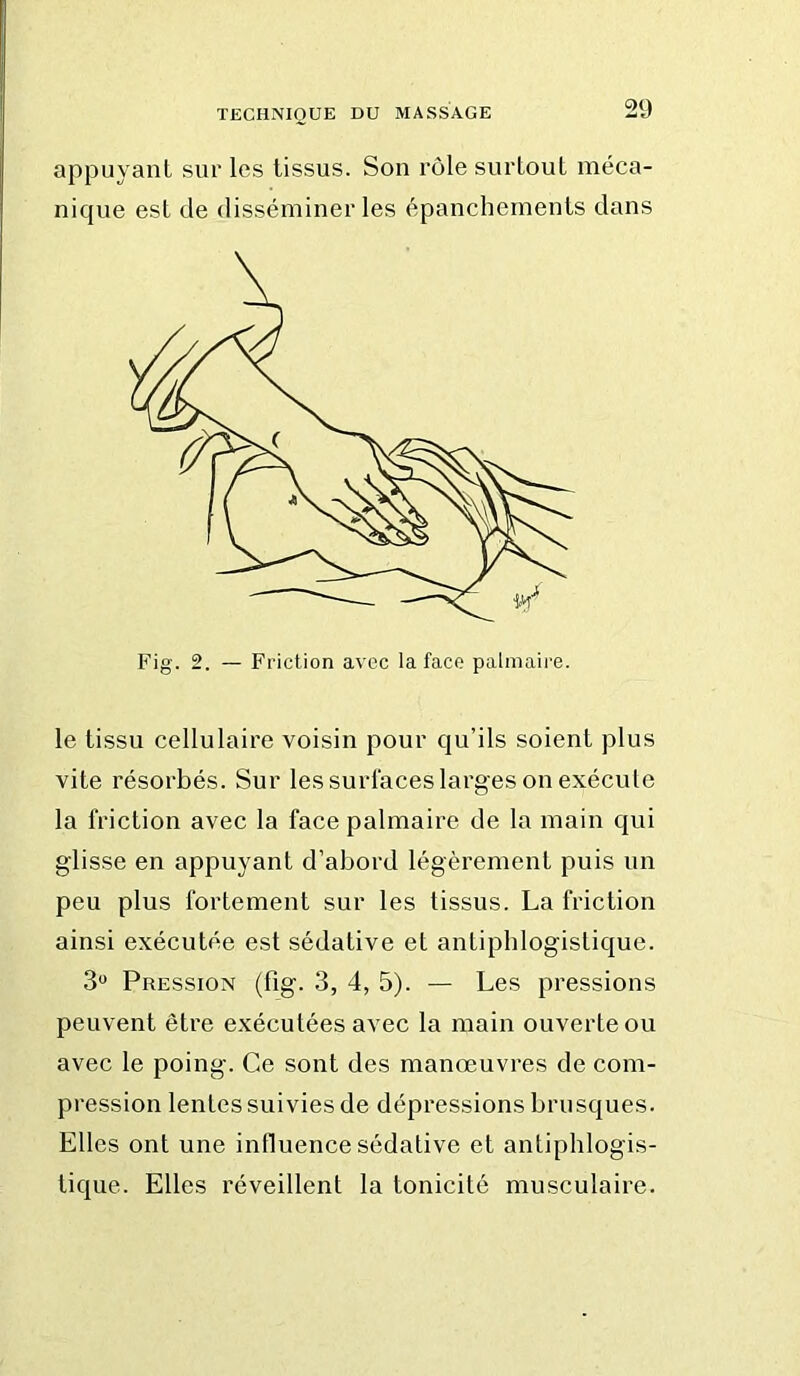 appuyant sur les tissus. Son rôle surtout méca- nique est de disséminer les épanchements dans le tissu cellulaire voisin pour qu’ils soient plus vite résorbés. Sur les surlaces larges on exécute la friction avec la face palmaire de la main qui glisse en appuyant d’abord légèrement puis un peu plus fortement sur les tissus. La friction ainsi exécutée est sédative et antiphlogistique. 3“ Pression (fig. 3, 4, 5). — Les pressions peuvent être exécutées avec la main ouverte ou avec le poing. Ce sont des manœuvres de com- pression lentes suivies de dépressions brusques. Elles ont une influence sédative et antiphlogis- tique. Elles réveillent la tonicité musculaire.