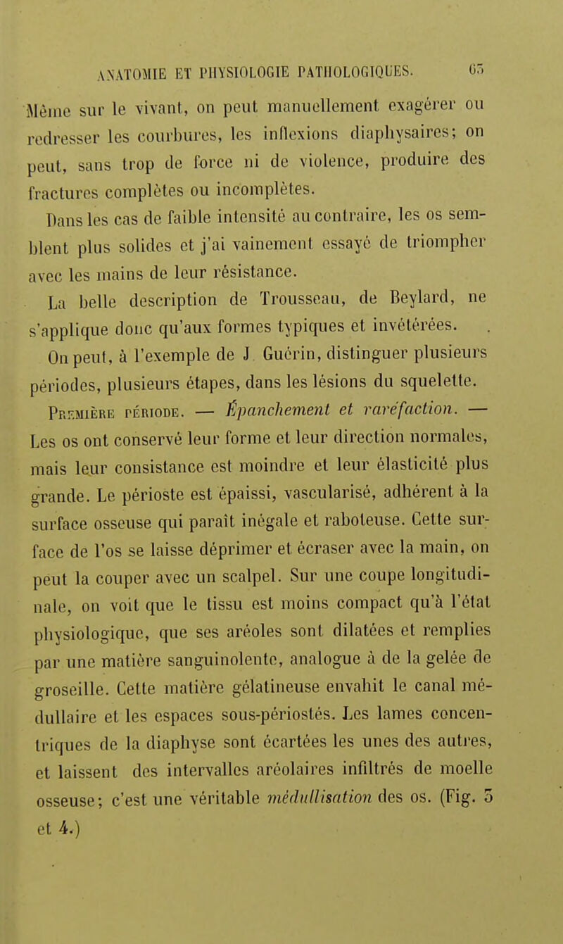 Même sur le vivant, on peut manuellement exagérer ou redresser les courbures, les inflexions diaphysaires; on peut, sans trop de force ni de violence, produire des fractures complètes ou incomplètes. Dans les cas de faible intensité au contraire, les os sem- blent plus solides et j'ai vainement essayé de triompher avec les mains de leur résistance. La belle description de Trousseau, de Beylard, ne s'applique donc qu'aux formes typiques et invétérées. On peut, à l'exemple de J Gucrin, distinguer plusieurs périodes, plusieurs étapes, dans les lésions du squelette. Pr.^.mière rÉRioDE. — Épanchement et raréfaction. — Les os ont conservé leur forme et leur direction normales, mais leur consistance est moindre et leur élasticité plus grande. Le périoste est épaissi, vascularisé, adhérent à la surface osseuse qui paraît inégale et raboteuse. Cette sur^ face de l'os se laisse déprimer et écraser avec la main, on peut la couper avec un scalpel. Sur une coupe longitudi- nale, on voit que le tissu est moins compact qu'à l'étal physiologique, que ses aréoles sont dilatées et remplies par une matière sanguinolente, analogue à de la gelée de groseille. Cette matière gélatineuse envahit le canal mé- dullaire et les espaces sous-périostés. Les lames concen- triques de la diaphyse sont écartées les unes des autj'es, et laissent des intervalles aréolaires infiltrés de moelle osseuse; c'est une véritable méditllisation ôes os. (Fig. 3