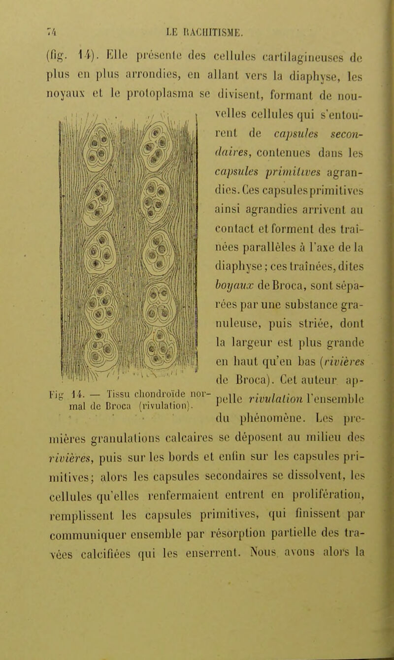 (fig. 14). Elle présoiili; des cellules cartilagineuses de plus en plus arrondies, en allant vers la diaphyse, les noyaux et le protoplasma se divisent, formant de nou- velles cellules qui s'entou- rent de capsules secon- daires, contenues dans les capsules -primitives agran- dies. Ces capsules primitives ainsi agrandies arrivent au contact et forment des traî- nées parallèles à l'axe de la diaphyse ; ces traînées, dites boyaux deBroca, sont sépa- rées par une substance gra- nuleuse, puis striée, dont la largeur est plus grande en haut qu'en bas {rivières de Broca). Cet auteur ap- pelle rivvlalion l'ensemble du phénomène. Les pi-c- mières granulations calcaires se déposent au milieu des rivières, puis sur les bords et enlin sur les capsules pri- mitives; alors les capsules secondaires se dissolvent, les cellules qu'elles renfermaient entrent en prolifération, remplissent les capsules primitives, qui finissent par communiquer ensemble par résorption partielle des tra- vées calcifiées qui les enserrent. Nous, avons alors la a. — Tissu cliondroïde nor- mal de Broca (rivulalion).