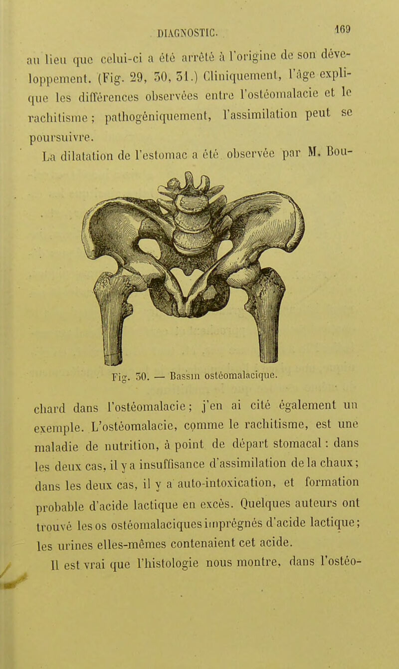 . DIAGiNOSTIC. If'-' au lieu que celui-ci a été arrèlé à loriginc de son déve- loppement. (Fig. 29, 30, 31.) Cliniquemenl, l'âge expli- que les différences observées entre l'ostéomalacie et le rachitisme; pathogéniquement, l'assimilation peut se poursuivre. La dilatation de l'estomac a été. observée par M. Bou- Fi-. 50. — Bassin ostéomalacique. chard dans l'ostéomalacie; j'en ai cité également un exemple. L'ostéomalacie, comme le rachitisme, est une maladie de nutrition, à point de départ stomacal : dans les deux cas, il y a insuffisance d'assimilation delà chaux; dans les deux cas, il y a auto-intoxication, et formation probable d'acide lactique en excès. Quelques auteurs ont trouvé les os ostéomalaciques imprégnés d'acide lactique; les urines elles-mêmes contenaient cet acide. Il est vrai que l'histologie nous montre, dans l'ostéo-