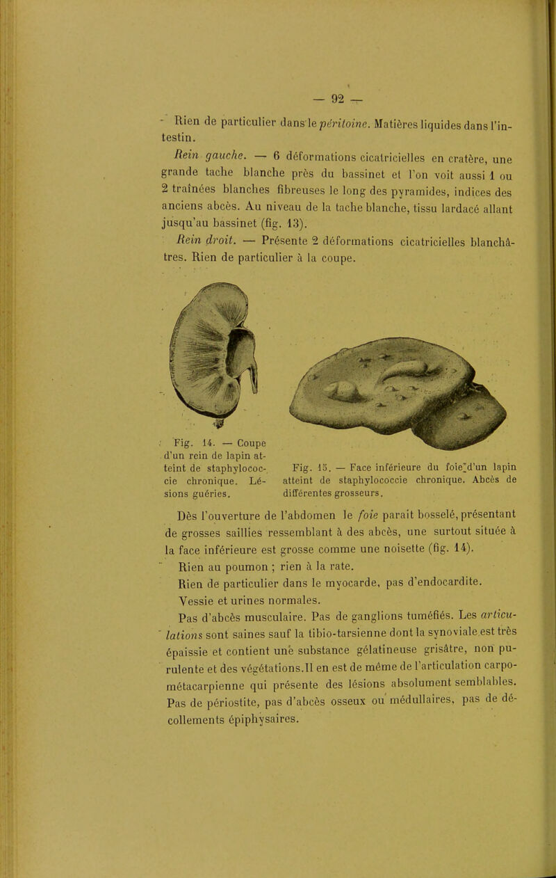 - Rien de particulier dansle péritoine. Matières liquides dans l'in- testin. Rein gauche. — 6 déformations cicatricielles en cratère, une grande tache blanche près du bassinet et l'on voit aussi 1 ou 2 traînées blanches fibreuses le long des pyramides, indices des anciens abcès. Au niveau de la tache blanche, tissu lardacé allant jusqu'au bassinet (fig. 13). Rein droit. — Présente 2 déformations cicatricielles blanchâ- tres. Rien de particulier à la coupe. d'un rein de lapin at- teint de staphylococ-, Fig. 15. — Face inférieure du foieM'un lapin cie chronique. Lé- atteint de staphylococcie chronique. Abcès de sions guéries. différentes grosseurs. Dès l'ouverture de l'abdomen le foie parait bosselé, présentant de grosses saillies ressemblant à des abcès, une surtout située à la face inférieure est grosse comme une noisette (fig. 14). Rien au poumon ; rien à la rate. Rien de particulier dans le myocarde, pas d'endocardite. Vessie et urines normales. Pas d'abcès musculaire. Pas de ganglions tuméfiés. Les articu- ' lotions sont saines sauf la tibio-tarsienne dont la synoviale est très épaissie et contient une substance gélatineuse grisâtre, nort pu- rulente et des végétations.11 en est de môme de l'articulation carpo- métacarpienne qui présente des lésions absolument semblables. Pas de périostite, pas d'abcès osseux ou médullaires, pas de dé- collements épiphysaires.