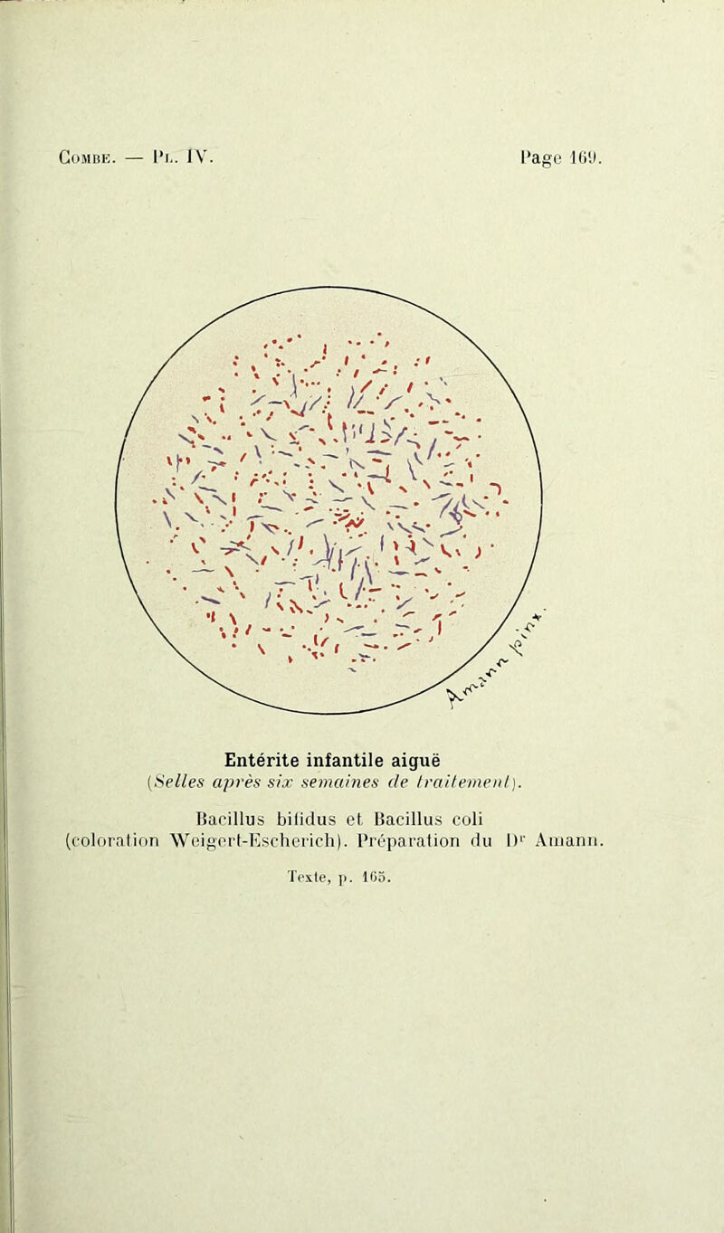 (Selles après six semaines de Iraifemeid}. Tiarillus bilidus et Bacillus coli (colornlion Weigoi’t-Kscherich). Préparation du I)'' Aiuann T(‘x(e, ]). 105.