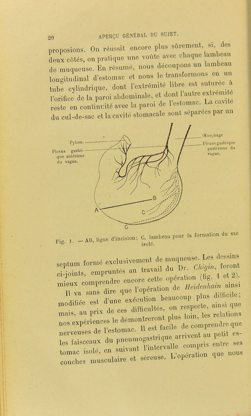 proposions. Oa réussil encore plus sûrement si des deux côtés, on pratique une voûte avec chaque amhean de muqueuse. En résumé, nous découpons un lambeau longitudinal d'estomac et nous le transformons en un tube cylindrique, dont l'extrémité libre est suturée a rorifice de la paroi abdominale, et dont l'autre extrém. é reste en continuité avec la paroi de l'estomac. La cuv.te du cul-de-sac et la cavité stomacale sont séparées par un Pylore. Plcsus gastri- que anlfrieur du vague. OEsoiiliage Plexus gastrique postérieur du vague. Fig. 1 _AB ligne d'incision; C, lambeau pour la formation du sac ' isolé. seotum formé exclusivement de muqueuse Les dessins - rts empruntés au travail du Dr C%», ï-ont Cl joims, J opération fig. 1 et 2). T^ rdirtV: ropération de -V-^^^^^- modifiée est d.ne ^-^^s^^^^^^^^^ mais, au prix de ces d.thcultes on j nerveuses de lestomau. m^ire et Séreuse. L'opération que nous