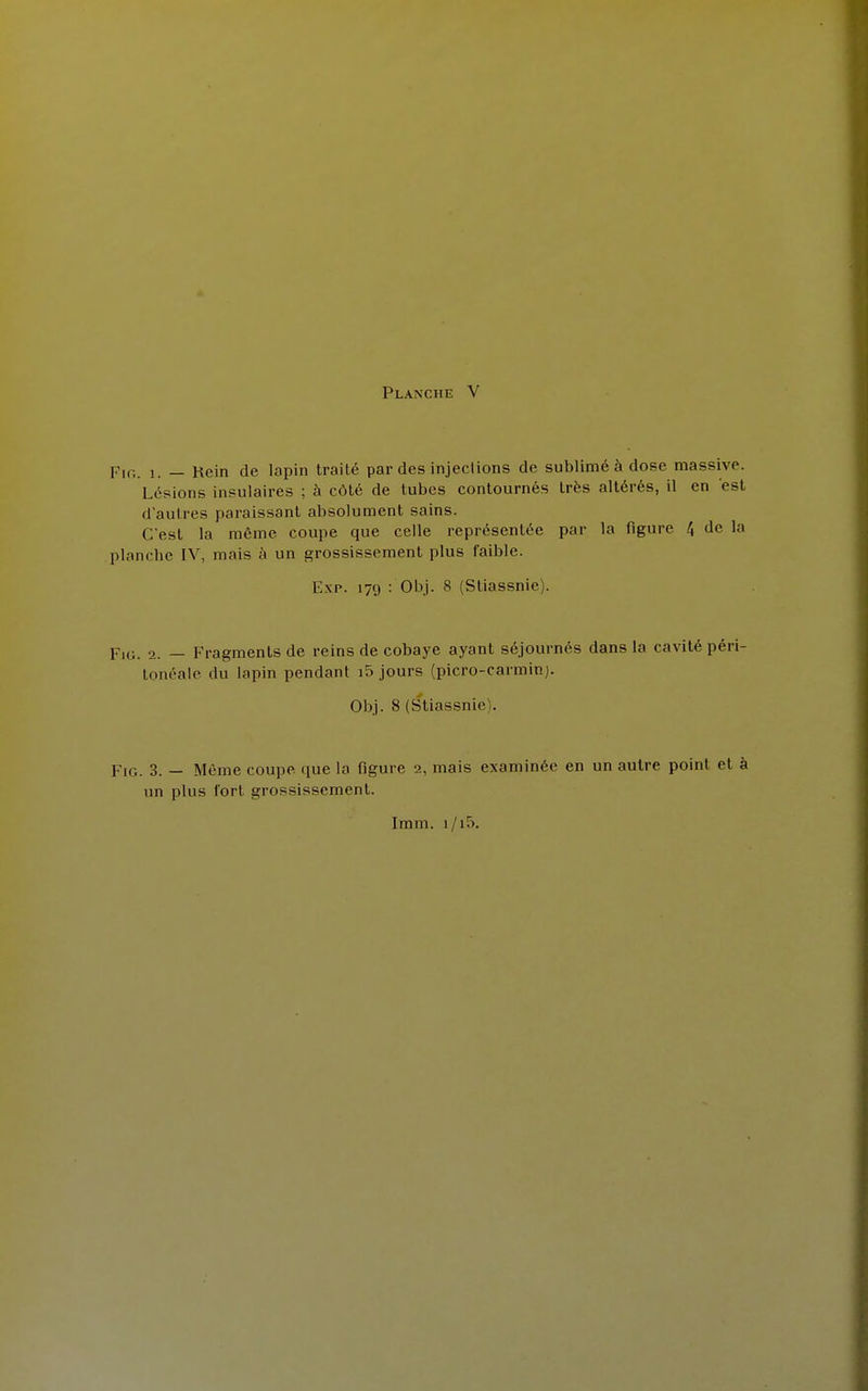 Fie. 1. — Rein de lapin traité par des injections de sublimé à dose massive. Lésions insulaires ; à côté de tubes contournés très altérés, il en est d'autres paraissant absolument sains. C'est la même coupe cpue celle représentée par la figure 4 de la planche IV, mais à un grossissement plus faible. Exp. 179 : Obj. 8 (Sliassnie). p1G. 2. — Fragments de reins de cobaye ayant séjournés dans la cavité péri- tonéale du lapin pendant i5 jours (picro-carminj. Obj. 8 (Stiassnic . Fie 3. — Même coupe que la figure 2, mais examinée en un autre point et à un plus fort grossissement. Imm. i/i5.