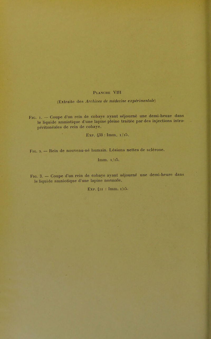 (Extraite des Archives de médecine expérimentale) Fig. 1. — Coupe d'un rein de cobaye ayant séjourné une demi-heuce dans le liquide amniotique d'une lapine pleine traitée par des injections intra- péritonéales de rein de cobaye. Exp. 433 : Imm. i/i5. Fig. 2. — Rein de nouveau-né humain. Lésions nettes de sclérose. Imm. i/i5. Fig. 3. — Coupe d'un rein de cobaye ayant séjourné une demi-heure dans le liquide amniotique d'une lapine normale. Exp. 421 : Imm. i/i5.