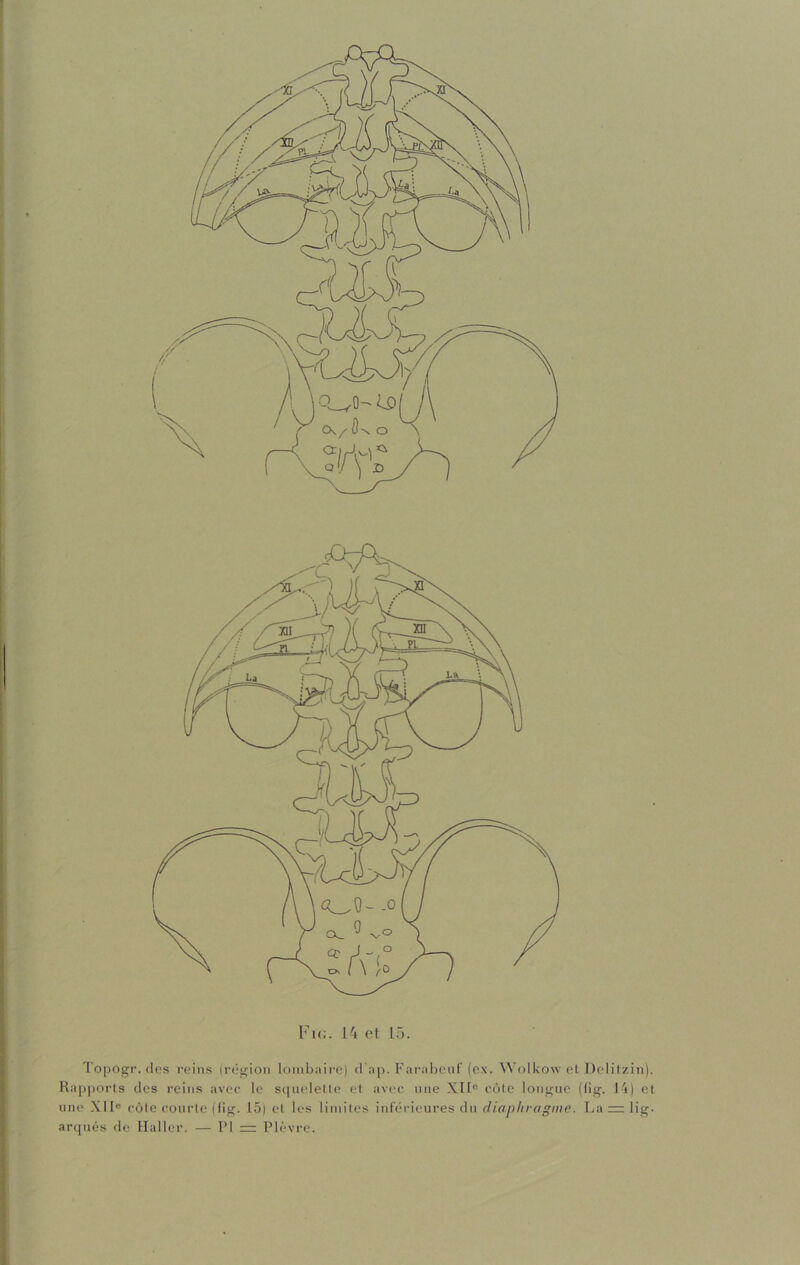 Topogr. des reins (région lombaire) d’ap. Farabcuf (ex. Wolkow et Delitzin). Rapports des reins avec le squelette et avec une XII0 côte longue (fig. 14) et une XIIe côte courte (fig. 15) et les limites inférieures du diaphragme. La = lig. arqués de Haller. — PI — Plèvre.