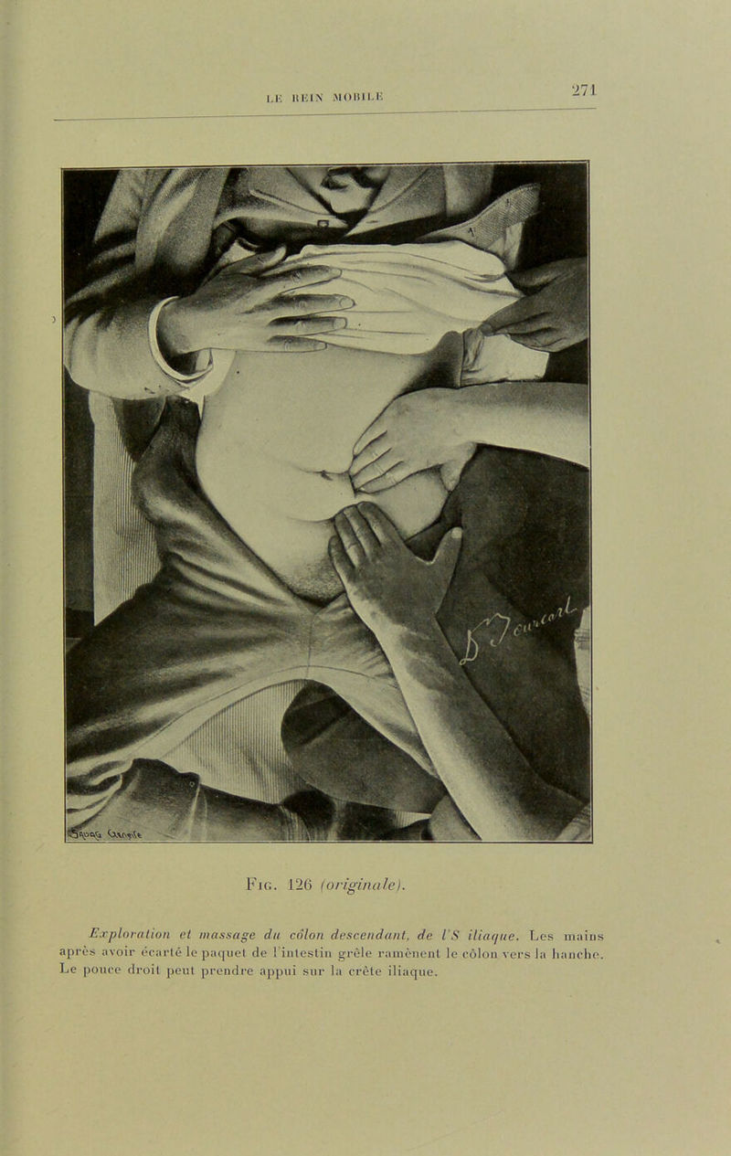 LK li Kl N iMOBILK Fig. 126 (originale). Exploration et massage du côlon descendant, de l’S iliaque. Les mains après avoir écarté le paquet de ! intestin grêle ramènent le côlon vers la hanche. Le pouce droit peut prendre appui sur la crête iliaque.