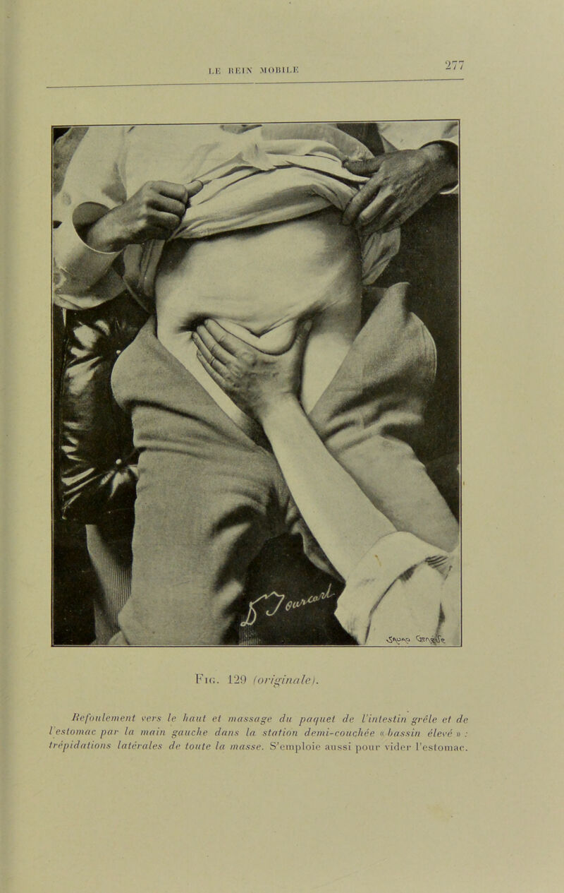 .15 REIN MOBILE Fie. 129 (originaleI. Refoulement vers le haut et massage du paquet de l’intestin grêle et de I estomac par la main gauche dans la station demi-coucfliée « bassin élevé » ; trépidations latérales de toute la masse. S’emploie aussi pour vider l’estomac.