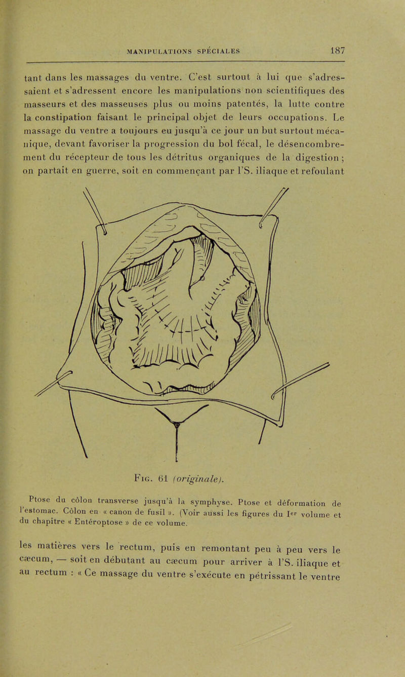 tant dans les massages du ventre. C’est surtout à lui que s’adres- saient et s’adressent encore les manipulations non scientifiques des masseurs et des masseuses plus ou moins patentés, la lutte contre la constipation faisant le principal objet de leurs occupations. Le massage du ventre a toujours eu jusqu’à ce jour un but surtout méca- nique, devant favoriser la progression du bol fécal, le désencombre- ment du récepteur de tons les détritus organiques de la digestion ; on partait en guerre, soit en commençant par l’S. iliaque et refoulant Fin. 61 ! originale}. ^ Ptose du côlon transverse jusqu’à la symphyse. Ptose et déformation de 1 estomac. Côlon en « canon de fusil ». (Voir aussi les figures du volume et du chapitre « Entéroptose » de ce volume. les matières vers le rectum, puis en remontant peu à peu vers le cæcum, — soit en débutant au cæcum pour arriver à l’S. iliaque et au rectum : « Ce massage du ventre s’exécute en pétrissant le ventre