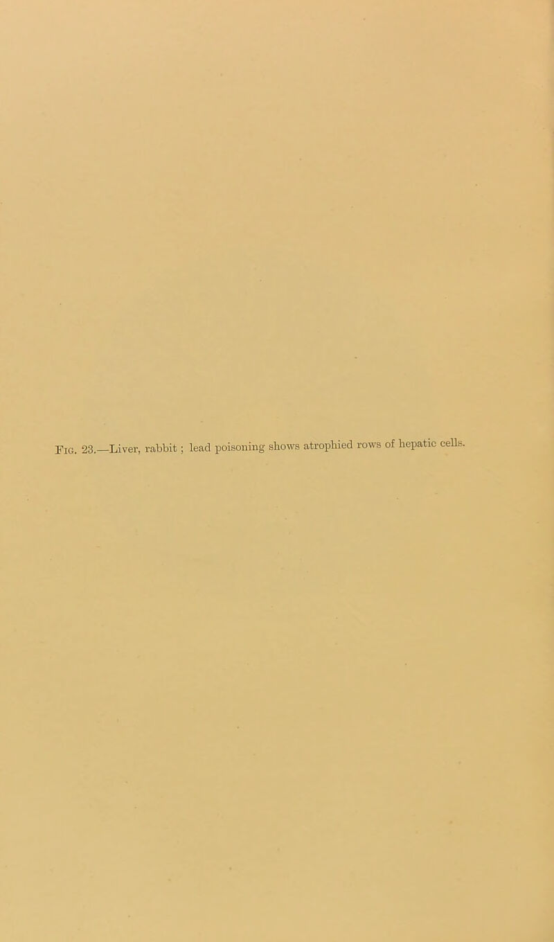 Fig. 23.—Liver, r.abbit; lead poisoning shows atrophied rows of hepatic cells.