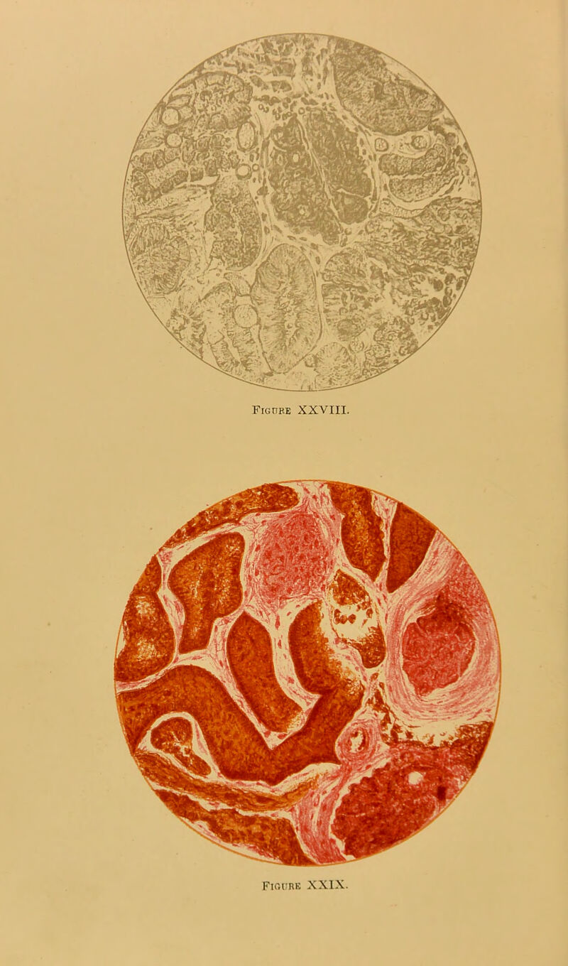 FlOURE XXIX.