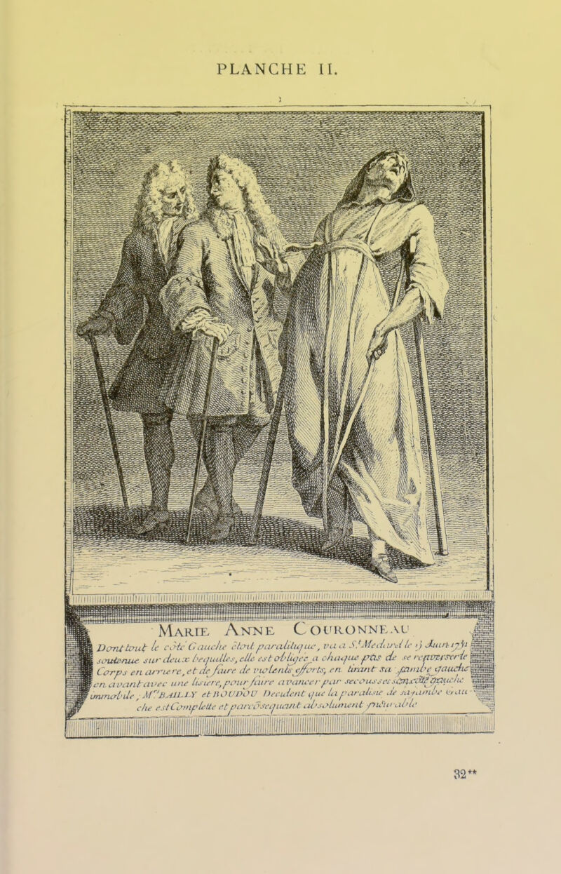 î Marte- Anne, Couronne au ’ cote Gauche était\parcUilujue, vau SlMcdiU'dle ij duulijrji •• deux becl utiles, elle estcJ’hqee a chiujiw fsùs cL' se reftüpfsxrle mere, et de /cure Je violents^ efforts, en tirant sa fan il'gauche ec une Usure, venir faire avancer far secousses s&fcâïfp&ucltc ’BAltL.Y et nOVDOU Décident c/ue la raralisie Je sa ranibe i<tau - stComplette et narcose quant absolument -nutiu aide jiffssigisi»! 32**