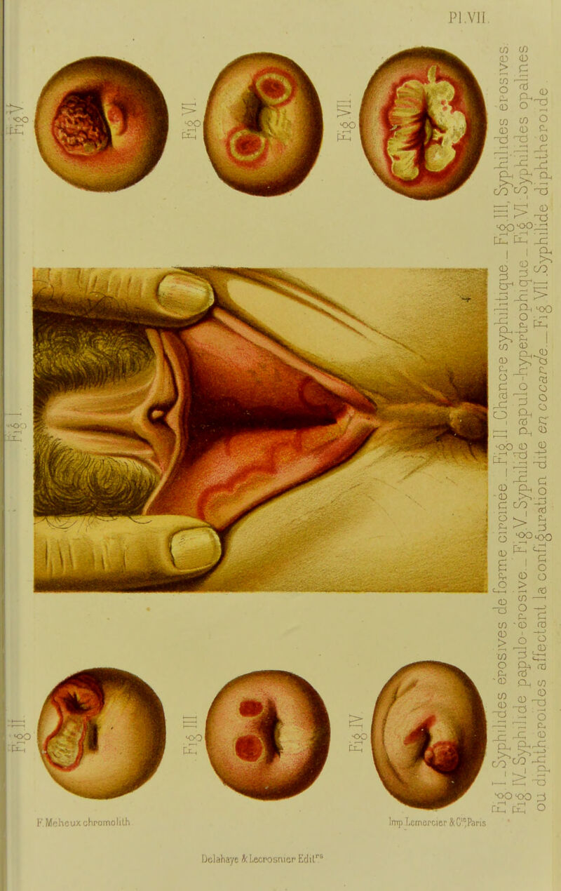 Pl.vil co If) <D <D > C OO 10 F. Mehcux chromolilh ImpLomePCier &C'^ Paris
