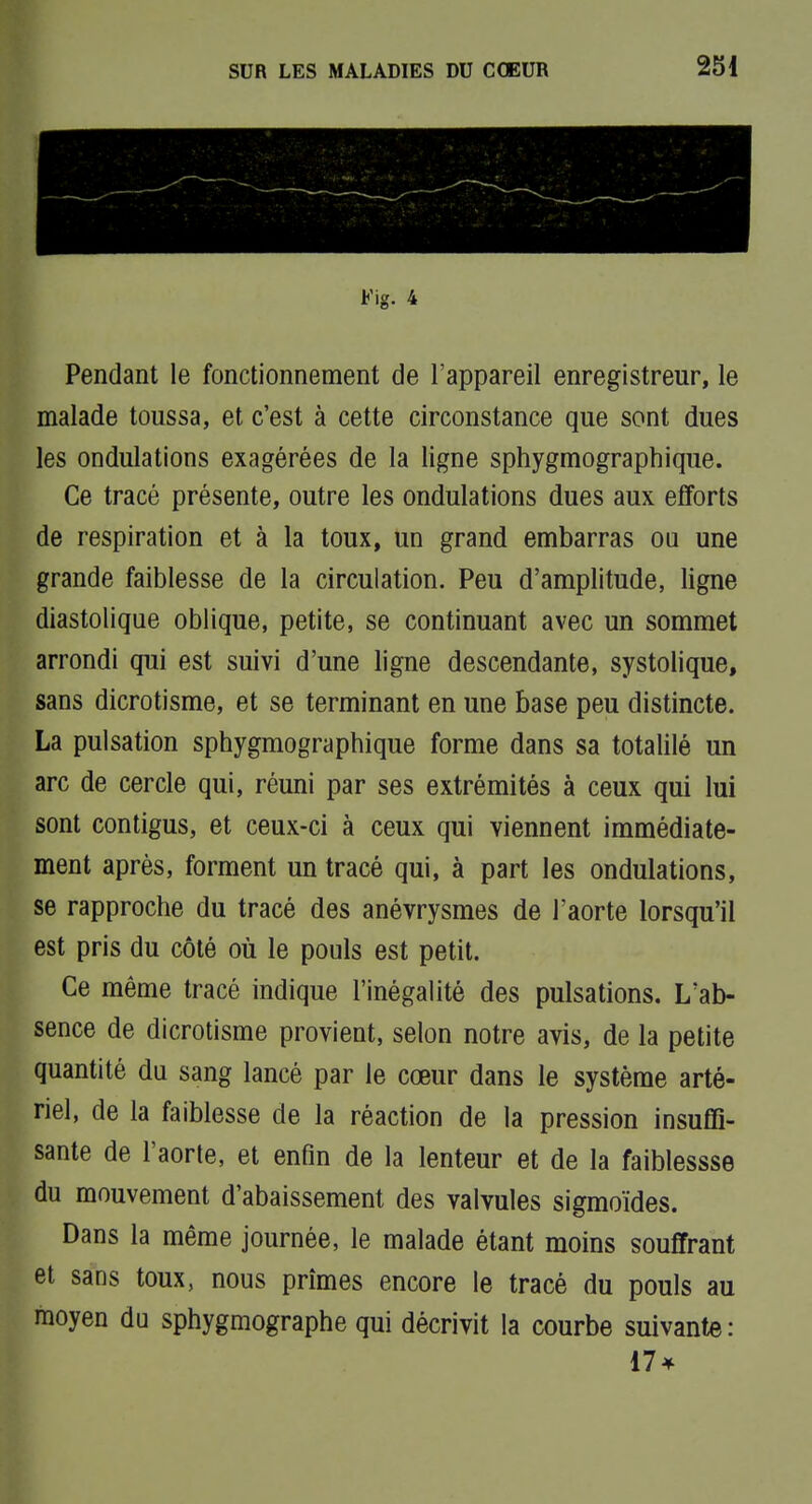 Fig. 4 Pendant le fonctionnement de l'appareil enregistreur, le malade toussa, et c'est à cette circonstance que sont dues les ondulations exagérées de la ligne sphygmographique. Ce tracé présente, outre les ondulations dues aux efforts de respiration et à la toux, un grand embarras ou une grande faiblesse de la circulation. Peu d'amplitude, ligne diastolique oblique, petite, se continuant avec un sommet arrondi qui est suivi d'une ligne descendante, systolique, sans dicrotisme, et se terminant en une base peu distincte. La pulsation sphygmographique forme dans sa totalilé un arc de cercle qui, réuni par ses extrémités à ceux qui lui sont contigus, et ceux-ci à ceux qui viennent immédiate- ment après, forment un tracé qui, à part les ondulations, se rapproche du tracé des anévrysmes de l'aorte lorsqu'il est pris du côté où le pouls est petit. Ce même tracé indique l'inégalité des pulsations. L'ab- sence de dicrotisme provient, selon notre avis, de la petite quantité du sang lancé par le cœur dans le système arté- riel, de la faiblesse de la réaction de la pression insuffi- sante de l'aorte, et enfm de la lenteur et de la faiblessse du mouvement d'abaissement des valvules sigmoïdes. Dans la même journée, le malade étant moins souffrant et sans toux, nous prîmes encore le tracé du pouls au moyen du sphygmographe qui décrivit la courbe suivante: 17*