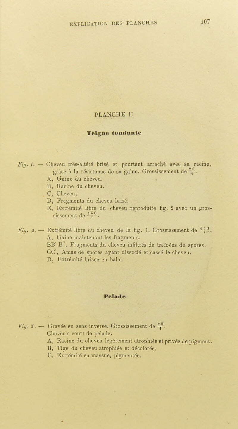 PLANCHE II Teig^nc tonilaiite Fig. -/. — Cheveu très-altéré brisé et pourtant arraché avec sa racine, grâce à la résistance de sa gaine. Grossissement de A, Gaîne du cheveu. B, Racine du cheveu. C, Cheveu. D, Fragments du cheveu brisé. E, Extrémité libre du cheveu reproduite fig. 2 avec un gros- sissement de Fig, 2- — Extrémité libre du cheveu de la fig. 1. Grossissement de ^f-. A, Gaîne maintenant les fragments. BB' B ', Fragments du cheveu infiltrés de traînées de spores, ce. Amas de spores ayant dissocié et cassé le cheveu. D, Extrémité brisée en balai. Pelade Fig. 3. — Gravée en sens inverse. Grossissement de Cheveux court de pelade. A, Racine du cheveu légèrement atrophiée et privée de pigment. B, Tige du cheveu atrophiée et décolorée. C, Extrémité en massue, pigmentée.