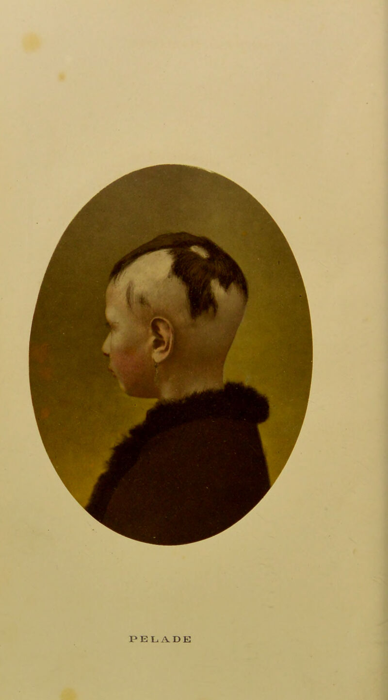 PELADE