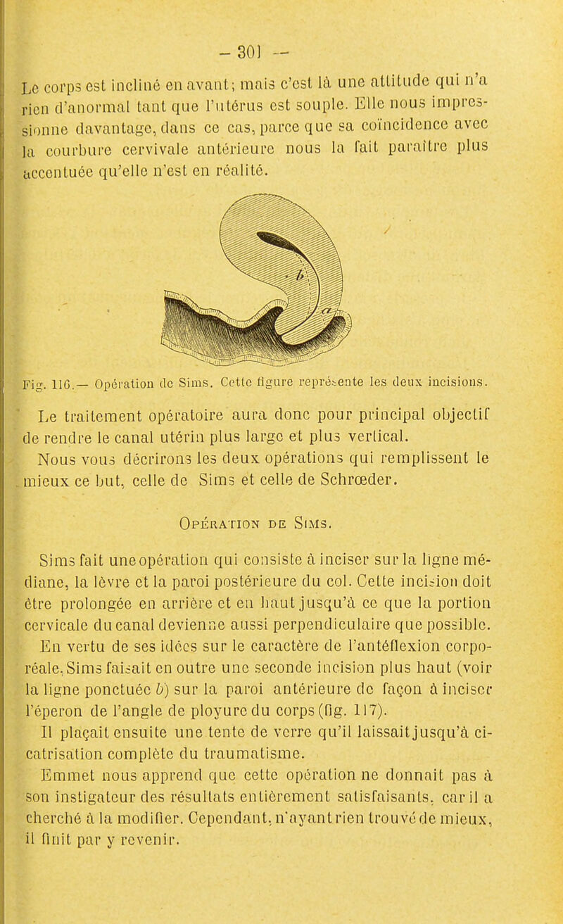 -301 - Le corps est incliné en avant; mais c'est là une attitude qui n'a rien d'anormal tant que l'utérus est souple. Elle nous impres- sionne davantage, dans ce cas, parce que sa coïncidence avec la courbure cervivale antérieure nous la fait paraître plus uccentuée qu'elle n'est en réalité. Fig. IIG.— Opération de Sims. Cette figure représente les deux incisions. Le traitement opératoire aura donc pour principal objectif de rendre le canal utérin plus large et plus vertical. Nous vous décrirons les deux, opérations qui remplissent le , mieux ce but, celle de Sims et celle de Schrœder. Opération de Sims. Sims fait une opération qui consiste à inciser sur la ligne mé- diane, la lèvre et la paroi postérieure du col. Cette incision doit être prolongée en arrière et en haut jusqu'à ce que la portion cervicale du canal devienne aussi perpendiculaire que possible. En vertu de ses idées sur le caractère de l'antéflexion corpo- réale,Sim3 faisait en outre une seconde incision plus haut (voir la ligne ponctuée b) sur la paroi antérieure de façon à inciser l'éperon de l'angle de ployuredu corps (fig. 117). Il plaçait ensuite une tente de verre qu'il laissait jusqu'à ci- catrisation complète du traumatisme. Emmet nous apprend que cette opération ne donnait pas à son instigateur des résultats entièrement satisfaisants, car il a cherché à la modifier. Cependant, n'ayant rien trouvé de mieux, il finit par y revenir.