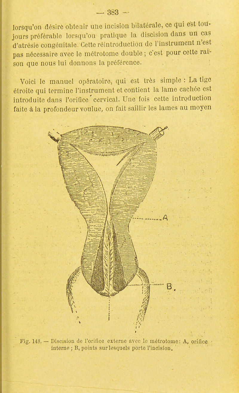 lorsqu'on désiré obtenir une incision bilatérale, ce (Jui e'st tou- jours préférable lorsqu'on pratique la discision dans uri cas d'atrésie congénitale, Cette réintroduction do l'instrument n'est pas nécessaire avec le métrotome double ; c'est pour cette rai- son que nous lui donnons la préférence. Voici le manuel opératoire, qui est très simple : La tige étroite qui termine l'instrument et contient la lame cachée est introduite dans rorifice ' cervical. Une fois cette introduction faite à la profondeur voulue, on fait saillir les lames au moyen Fig. 1-13. — Discisioa de l'orifice externe avec le métrotome : A, orifice interne ; B, points sur lesquels porto l'incision .
