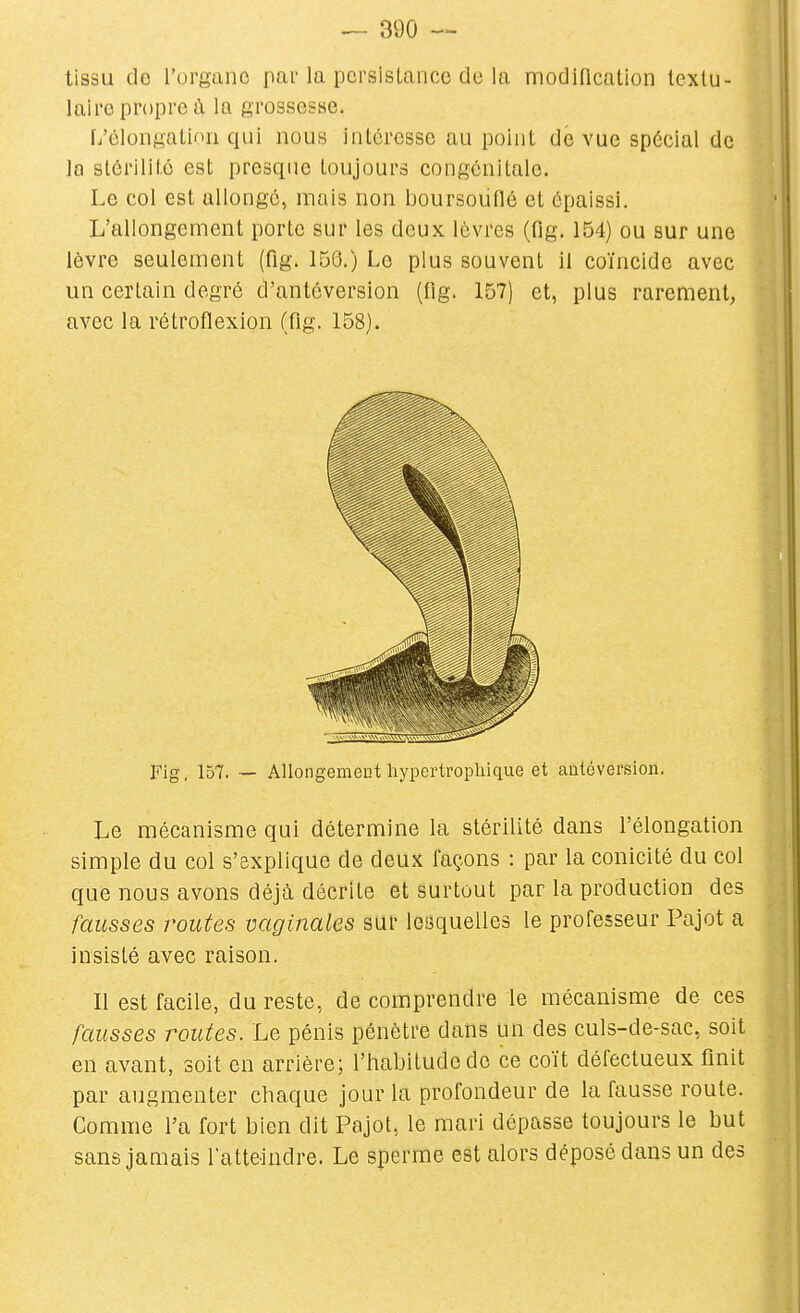 tissu de l'organe par la persistance de la modification texlu- laire propre à la grossesse. L'élongatinn qui nous intéresse au point de vue spécial de la stérilité est presque toujours congénitale. Le col est allongé, mais non boursouflé et épaissi. L'allongement porte sur les deux lèvres (flg. 154) ou sur une lèvre seulement (fig. 150.) Le plus souvent il coïncide avec un certain degré d'antéversion (flg. 157) et, plus rarement, avec la rétroflexion (flg. 158). Fig, 157. — Allongemeut hypertroplùque et autéversion. Le mécanisme qui détermine la stérilité dans l'élongation simple du col s'explique de deux façons : par la conicité du col que nous avons déjà décrite et surtout par la production des fausses routes vaginales sur lesquelles le professeur Pajot a insisté avec raison. Il est facile, du reste, de comprendre le mécanisme de ces fausses routes. Le pénis pénètre dans un des culs-de-sac, soit en avant, soit en arrière; l'habitude de ce coït défectueux finit par augmenter chaque jour la profondeur de la fausse route. Comme l'a fort bien dit Pajot, le mari dépasse toujours le but sans jamais l'atteindre. Le sperme est alors déposé dans un des